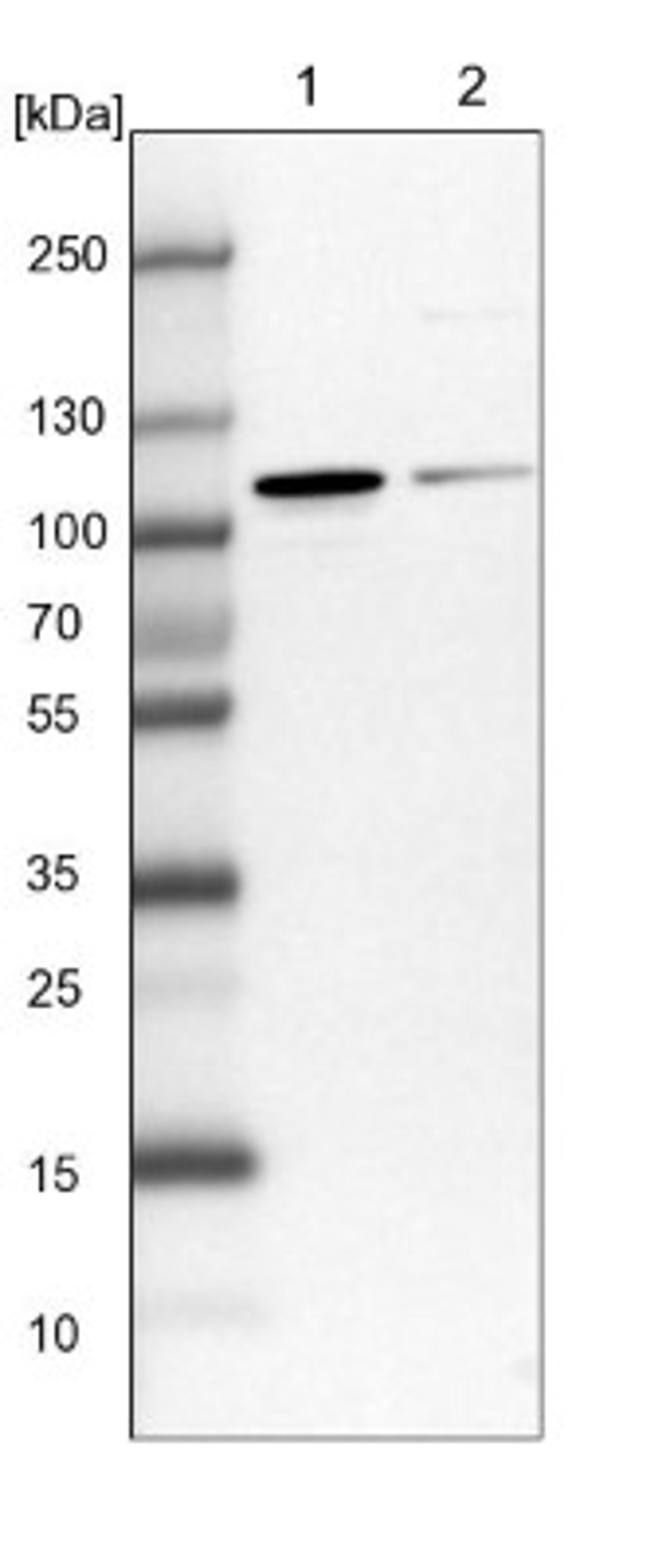 Western Blot: NVL Antibody [NBP1-89508] - Lane 1: NIH-3T3 cell lysate (Mouse embryonic fibroblast cells)<br/>Lane 2: NBT-II cell lysate (Rat Wistar bladder tumour cells)