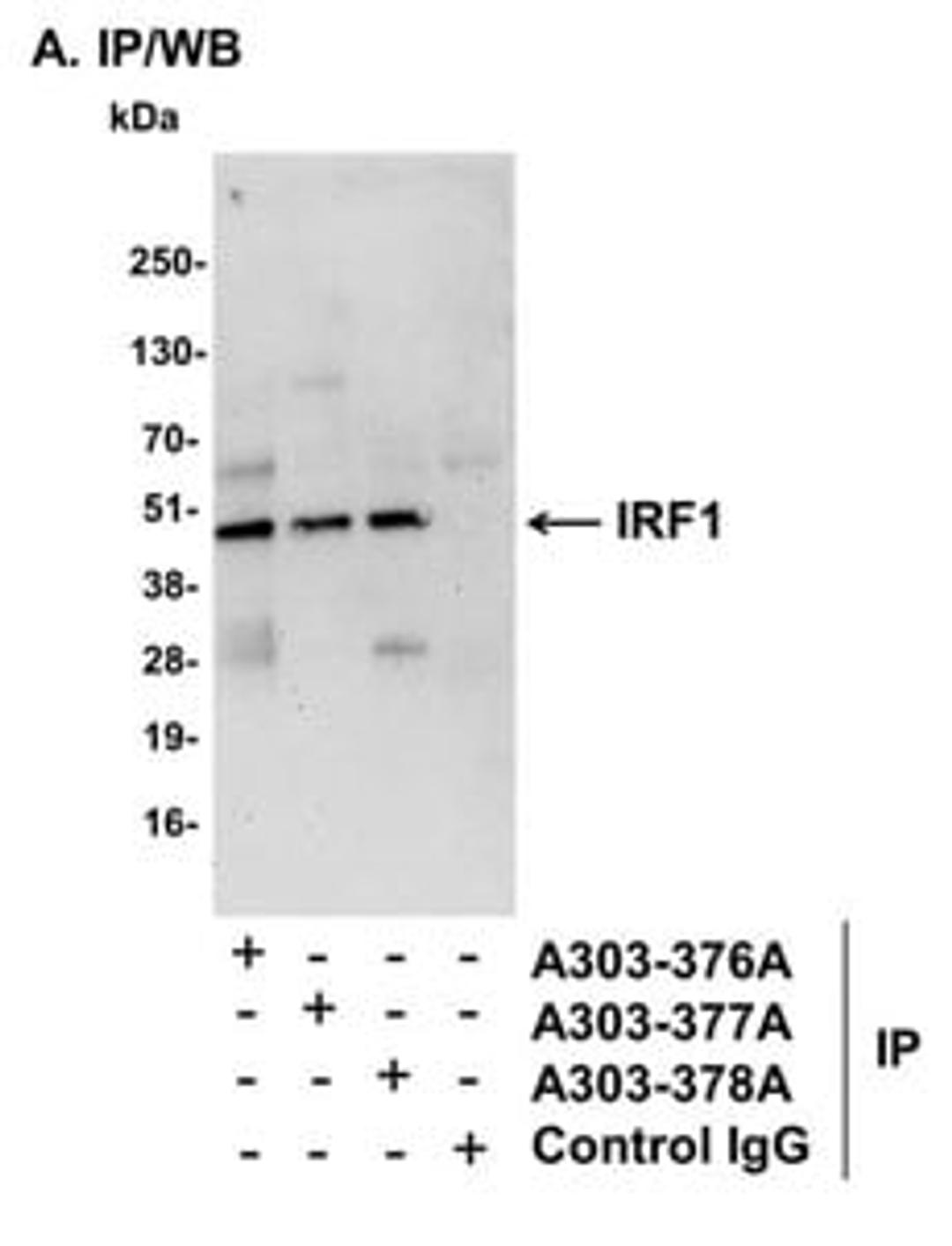 Detection of mouse IRF1 by western blot of immunoprecipitates.