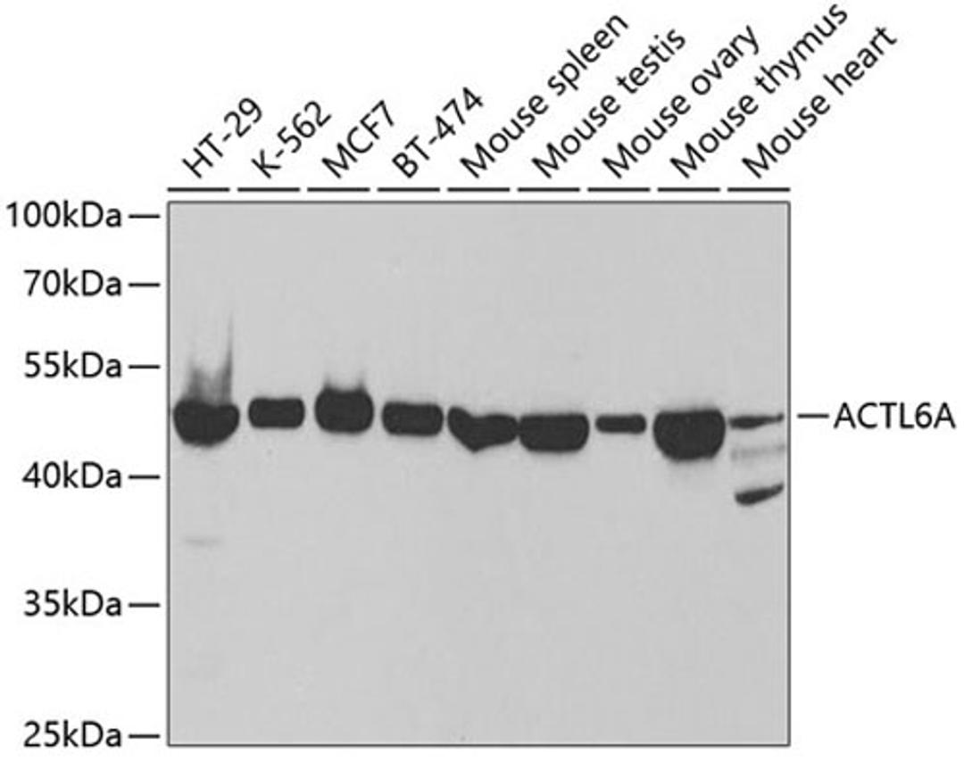 Western blot - ACTL6A antibody (A5387)