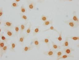 Immunocytochemistry analysis of CSB-PA010378PA105me1HU diluted at 1:20 and staining in Hela cells performed on a Leica BondTM system. The cells were fixed in 4% formaldehyde, permeabilized using 0.2% Triton X-100 and blocked with 10% normal goat serum 30min at RT. Then primary antibody (1% BSA) was incubated at 4°C overnight. The primary is detected by a biotinylated secondary antibody and visualized using an HRP conjugated SP system.