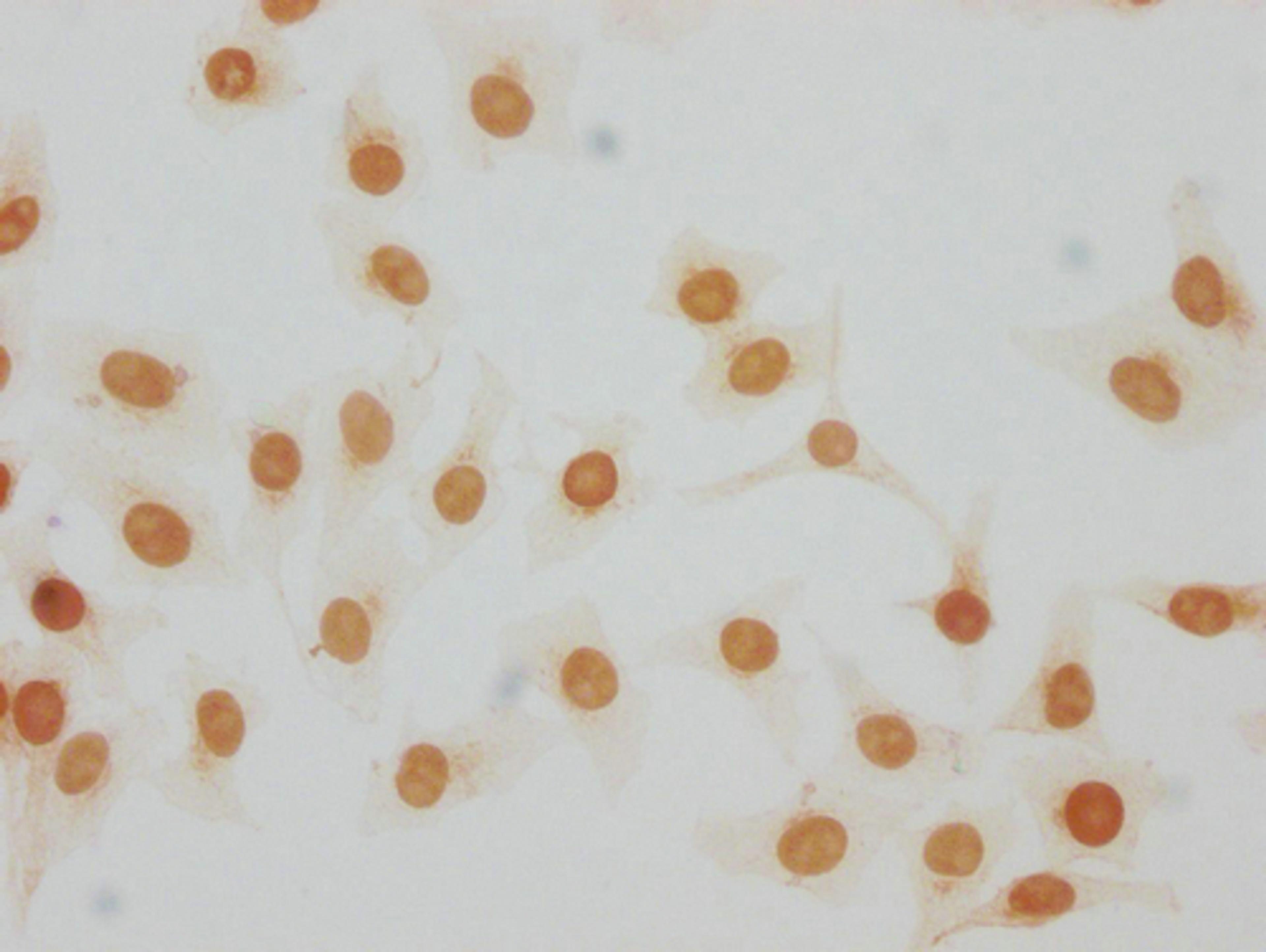 Immunocytochemistry analysis of CSB-PA010378PA105me1HU diluted at 1:20 and staining in Hela cells performed on a Leica BondTM system. The cells were fixed in 4% formaldehyde, permeabilized using 0.2% Triton X-100 and blocked with 10% normal goat serum 30min at RT. Then primary antibody (1% BSA) was incubated at 4°C overnight. The primary is detected by a biotinylated secondary antibody and visualized using an HRP conjugated SP system.