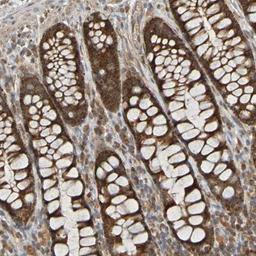 Immunohistochemistry-Paraffin: TMBIM1 Antibody [NBP1-81310] - Staining of human colon shows strong cytoplasmic positivity.