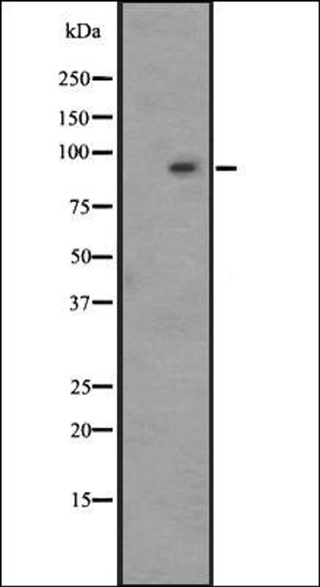 Western blot analysis of HepG2 whole cell lysate using GPR128 antibody