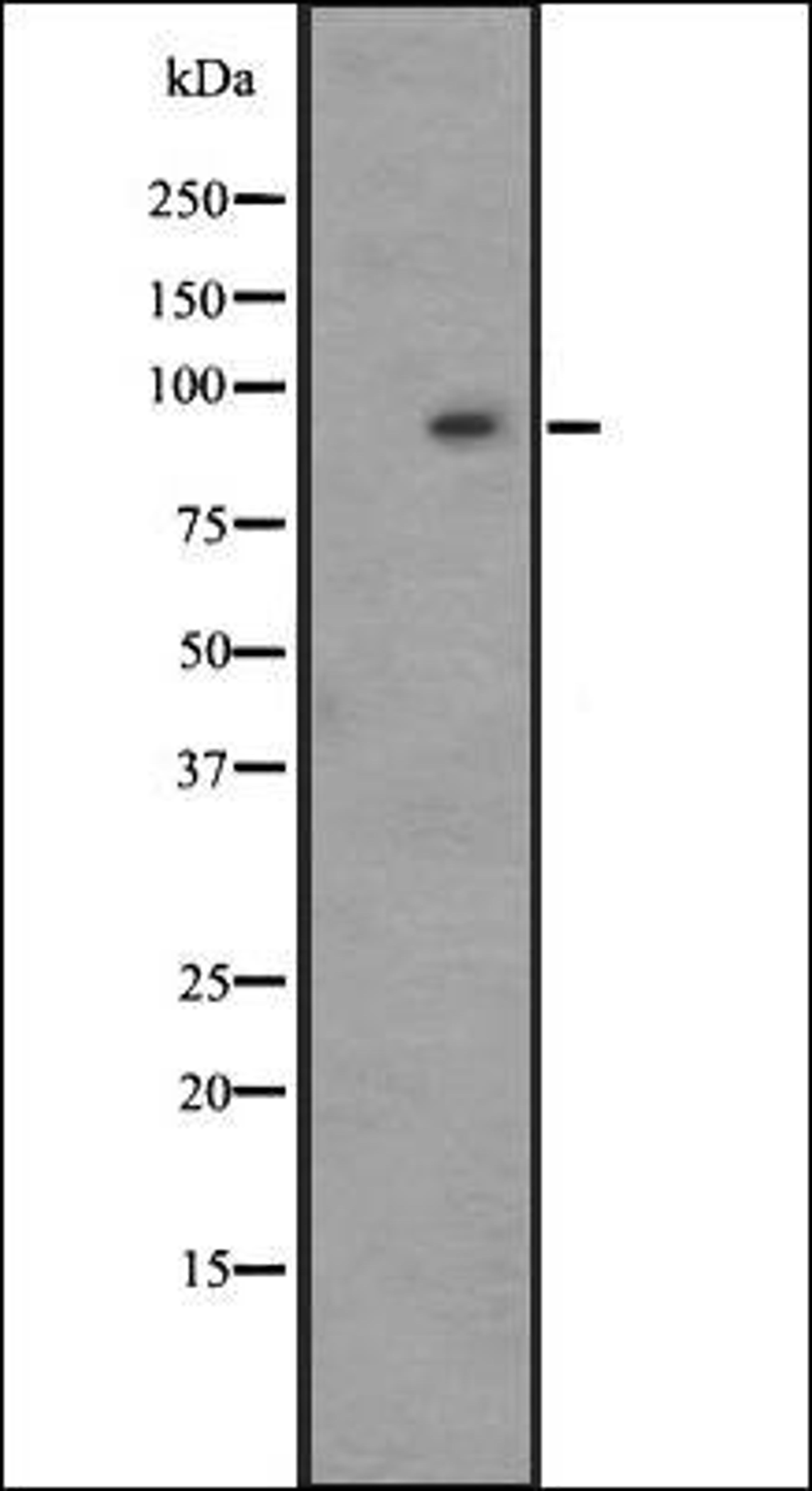 Western blot analysis of HepG2 whole cell lysate using GPR128 antibody