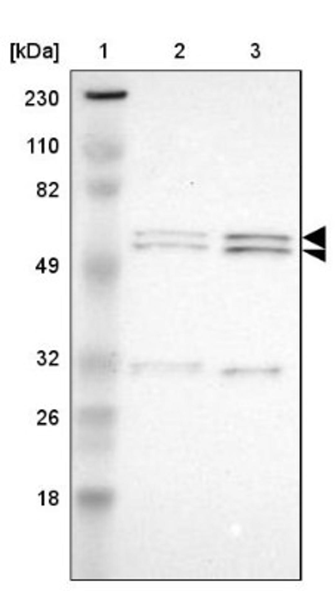 Western Blot: RGAG4 Antibody [NBP1-93561] - Lane 1: Marker [kDa] 230, 110, 82, 49, 32, 26, 18<br/>Lane 2: Human cell line RT-4<br/>Lane 3: Human cell line U-251MG sp