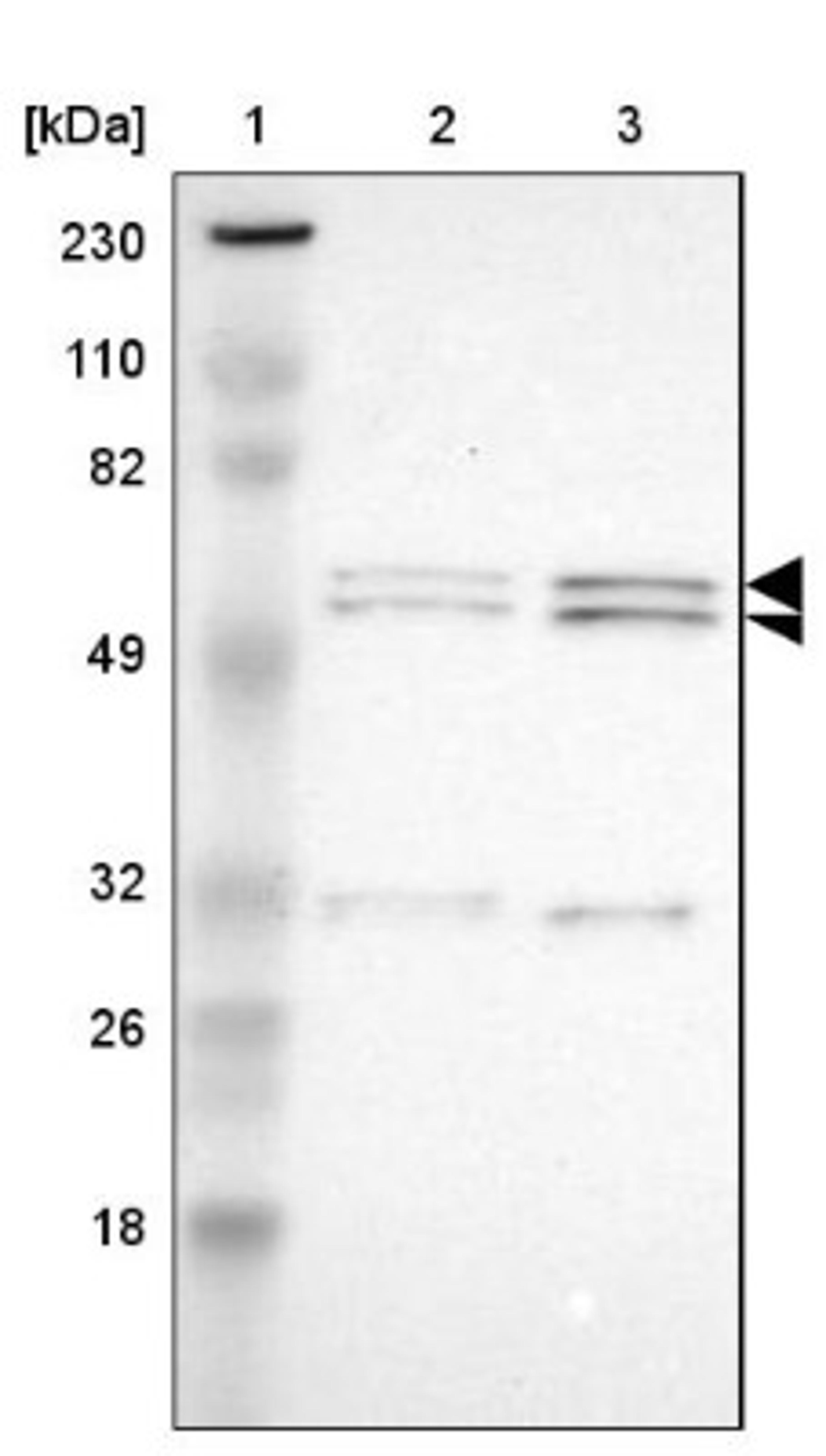 Western Blot: RGAG4 Antibody [NBP1-93561] - Lane 1: Marker [kDa] 230, 110, 82, 49, 32, 26, 18<br/>Lane 2: Human cell line RT-4<br/>Lane 3: Human cell line U-251MG sp