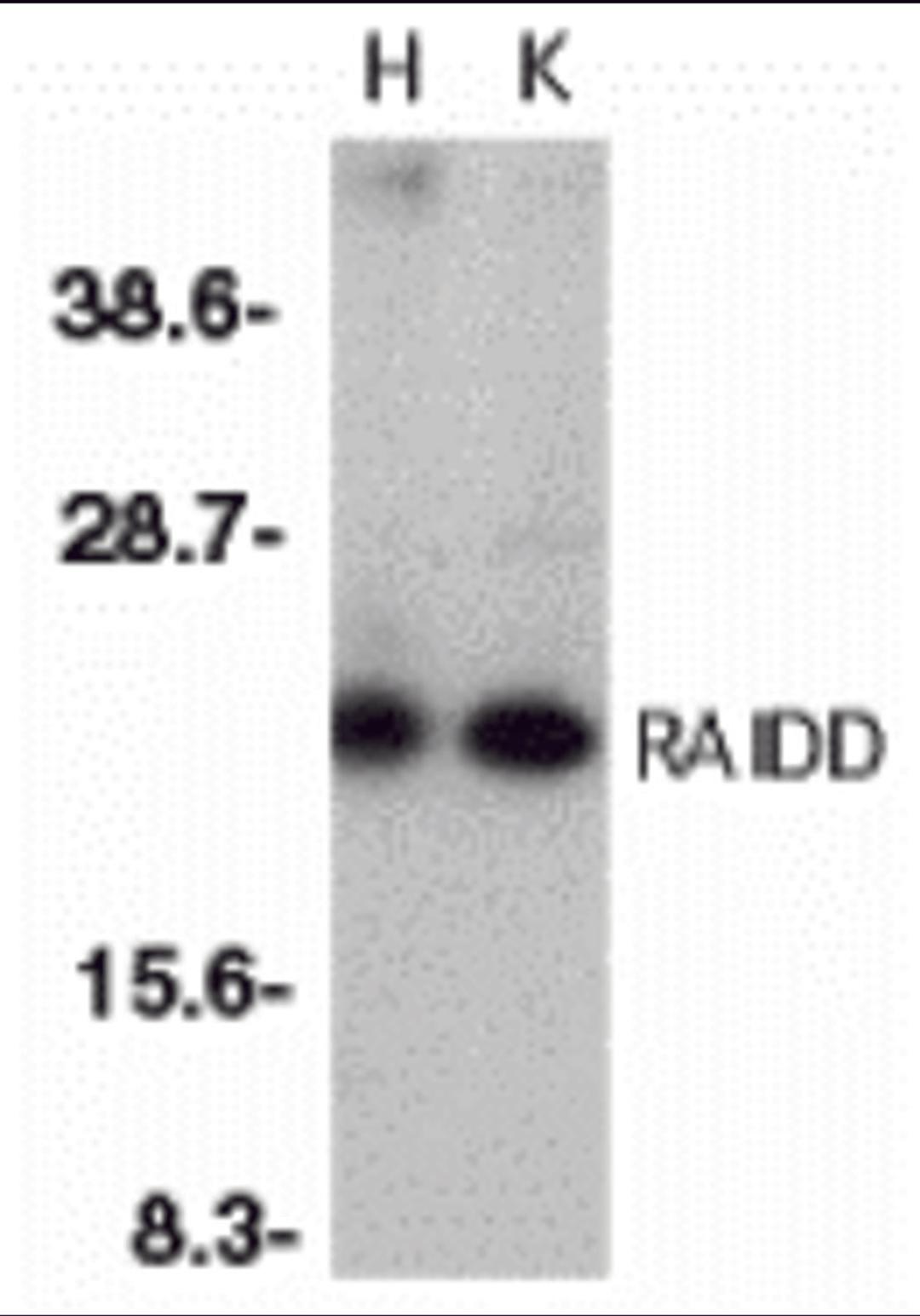 Western blot analysis of RAIDD in whole cell lysates from HeLa (H) or K562 (K) cells with RAIDD antibody at 1:500 dilution.