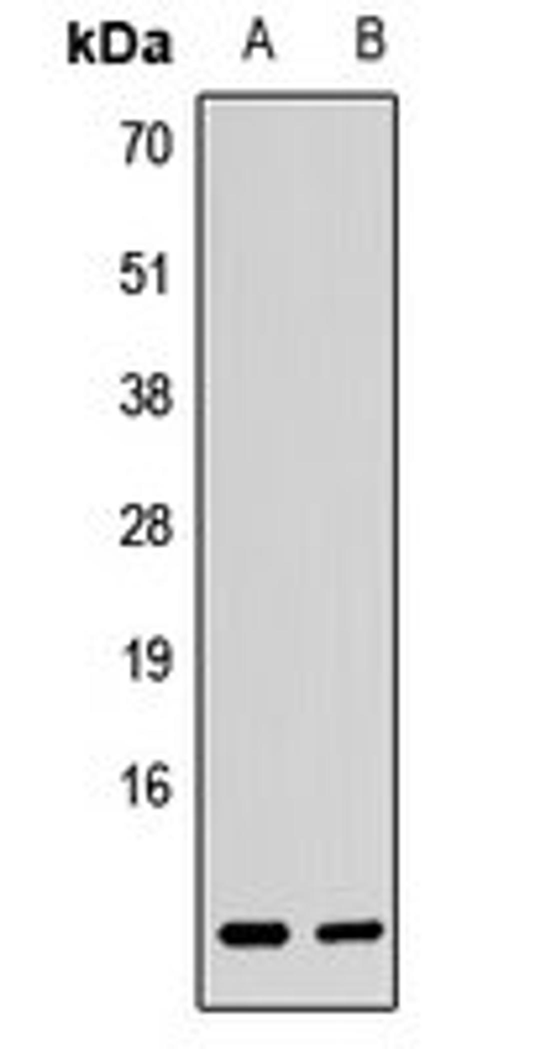 Western blot analysis of Jurkat (Lane1), K562 (Lane2) whole cell lysates using BET1L antibody