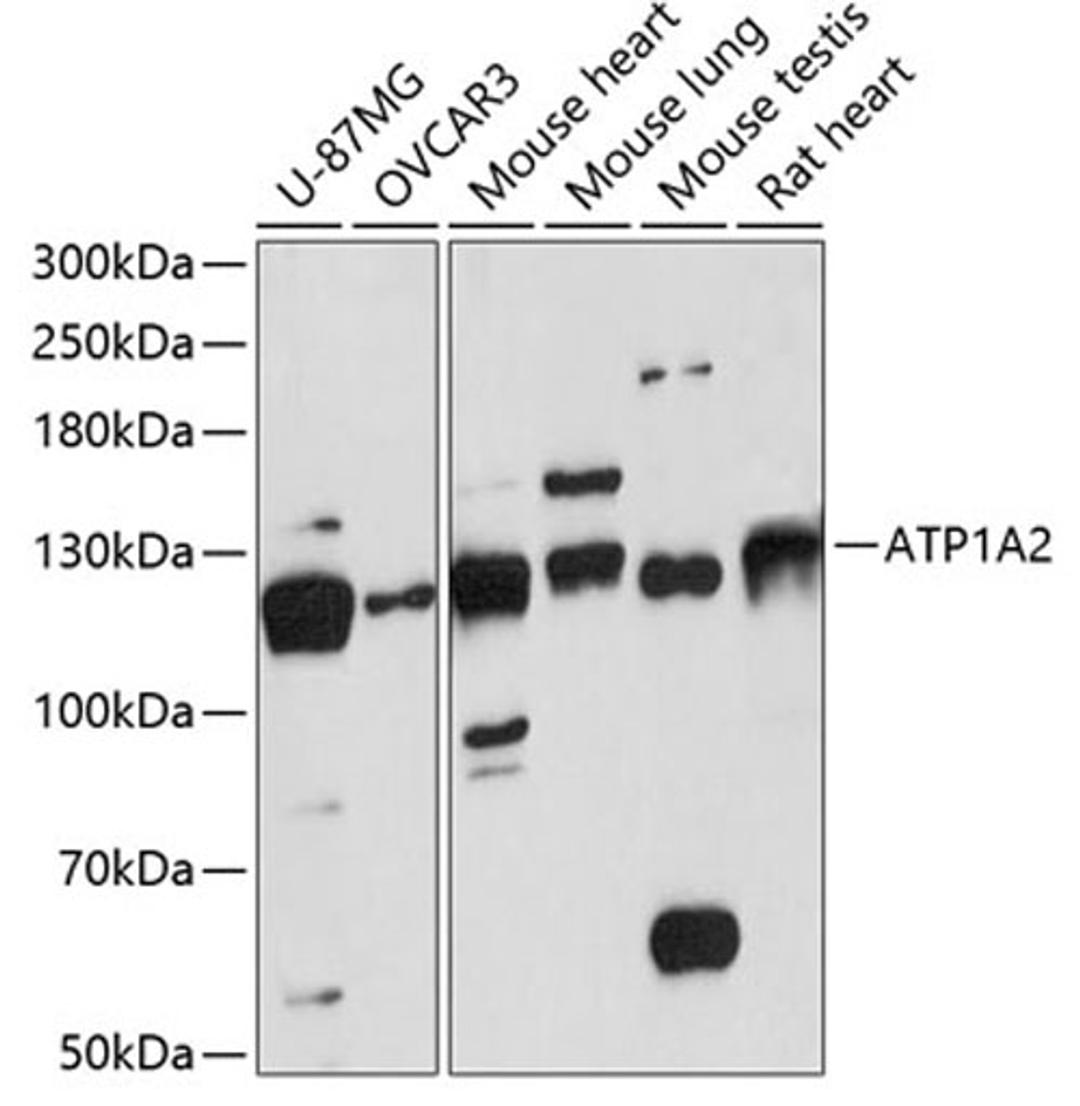 Western blot - ATP1A2 antibody (A13805)