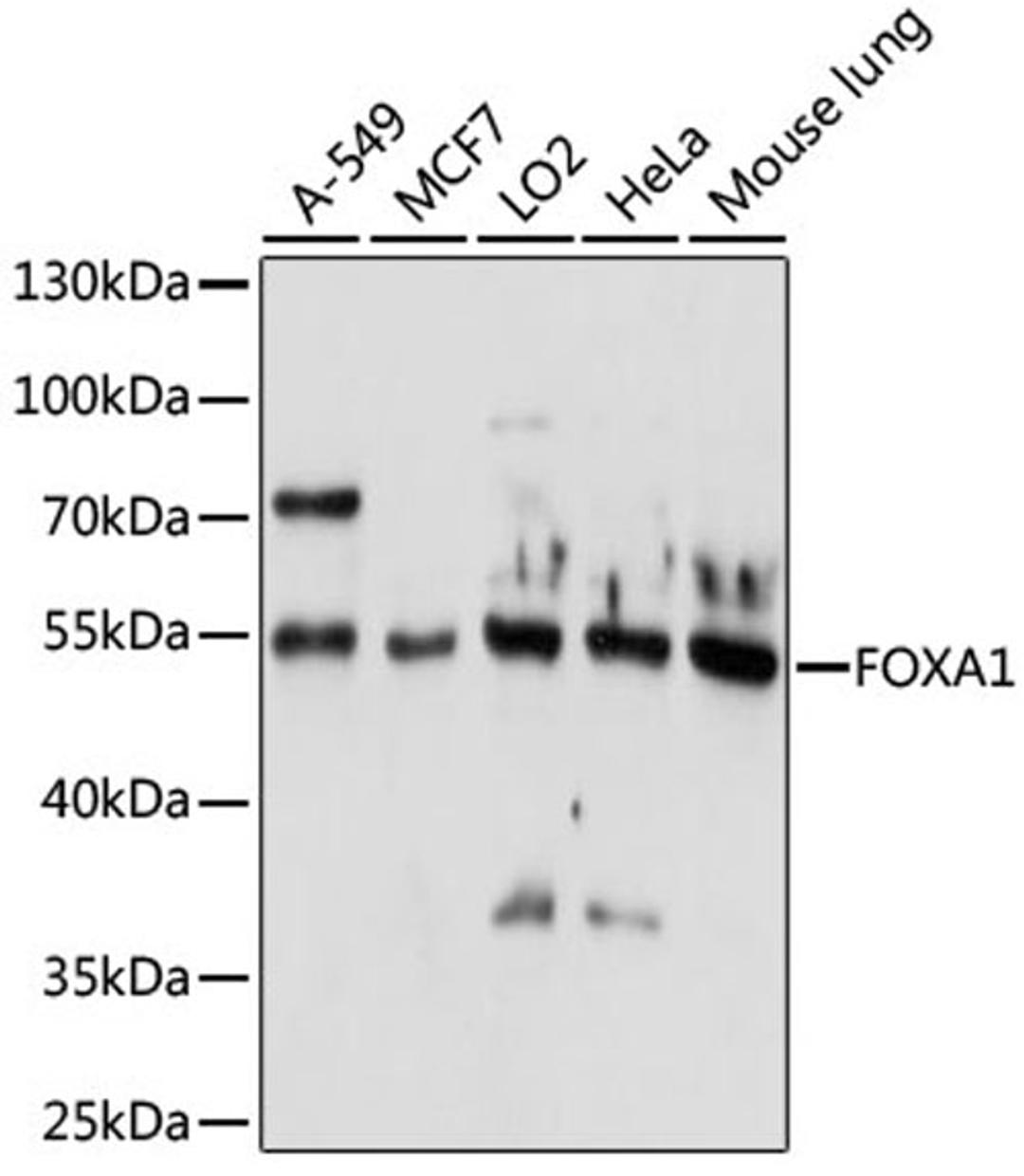 Western blot - FOXA1 antibody (A15278)