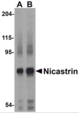 Western blot analysis of Nicastrin in human brain tissue lysate with Nicastrin antibody at (A) 0.5 and (B) 1&#956;g/mL.