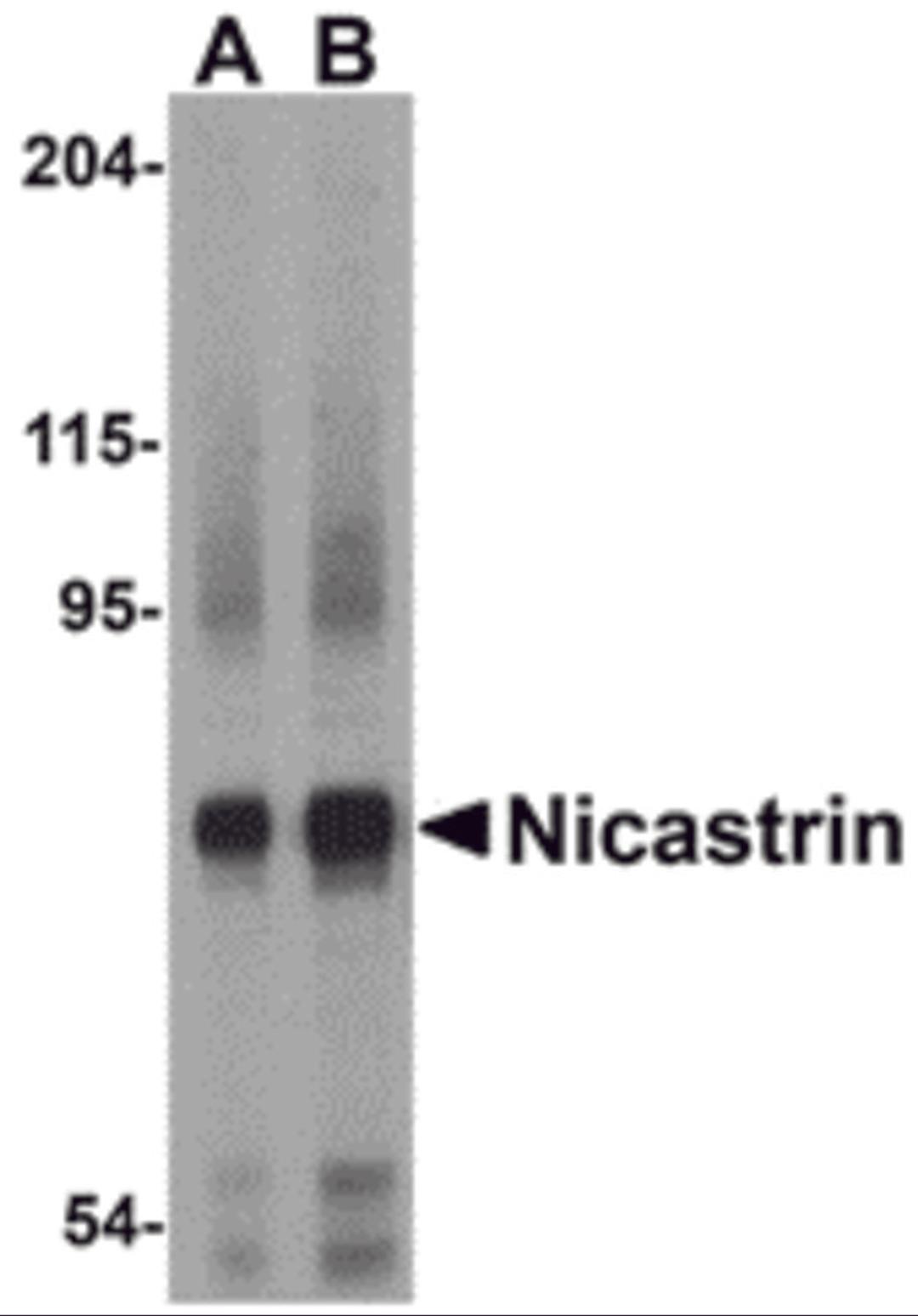 Western blot analysis of Nicastrin in human brain tissue lysate with Nicastrin antibody at (A) 0.5 and (B) 1μg/mL.
