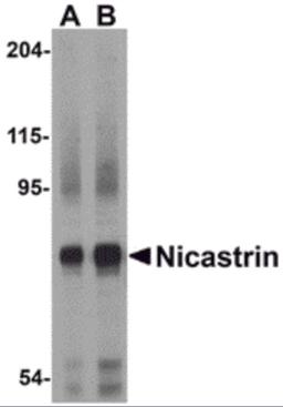 Western blot analysis of Nicastrin in human brain tissue lysate with Nicastrin antibody at (A) 0.5 and (B) 1μg/mL.