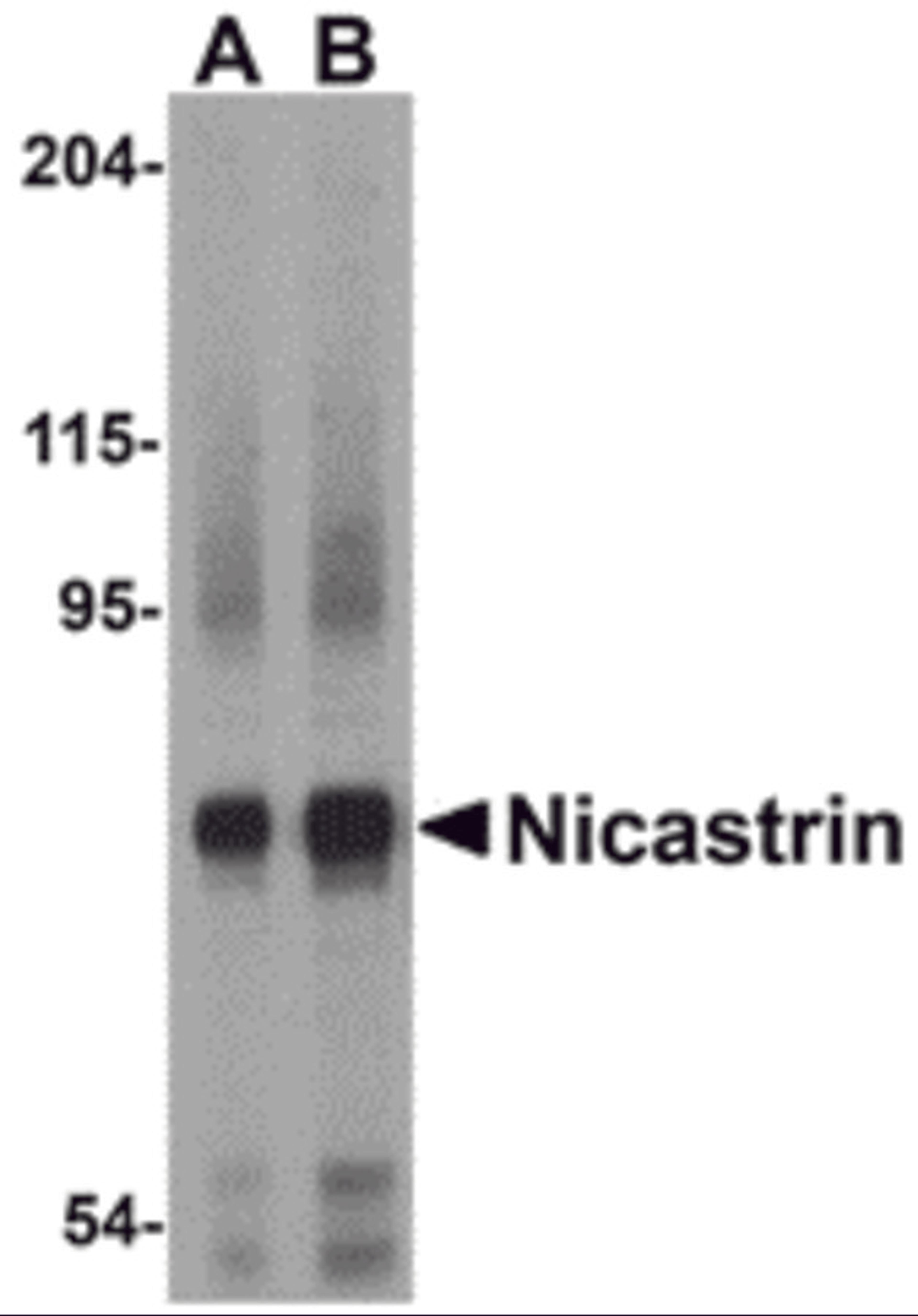 Western blot analysis of Nicastrin in human brain tissue lysate with Nicastrin antibody at (A) 0.5 and (B) 1μg/mL.