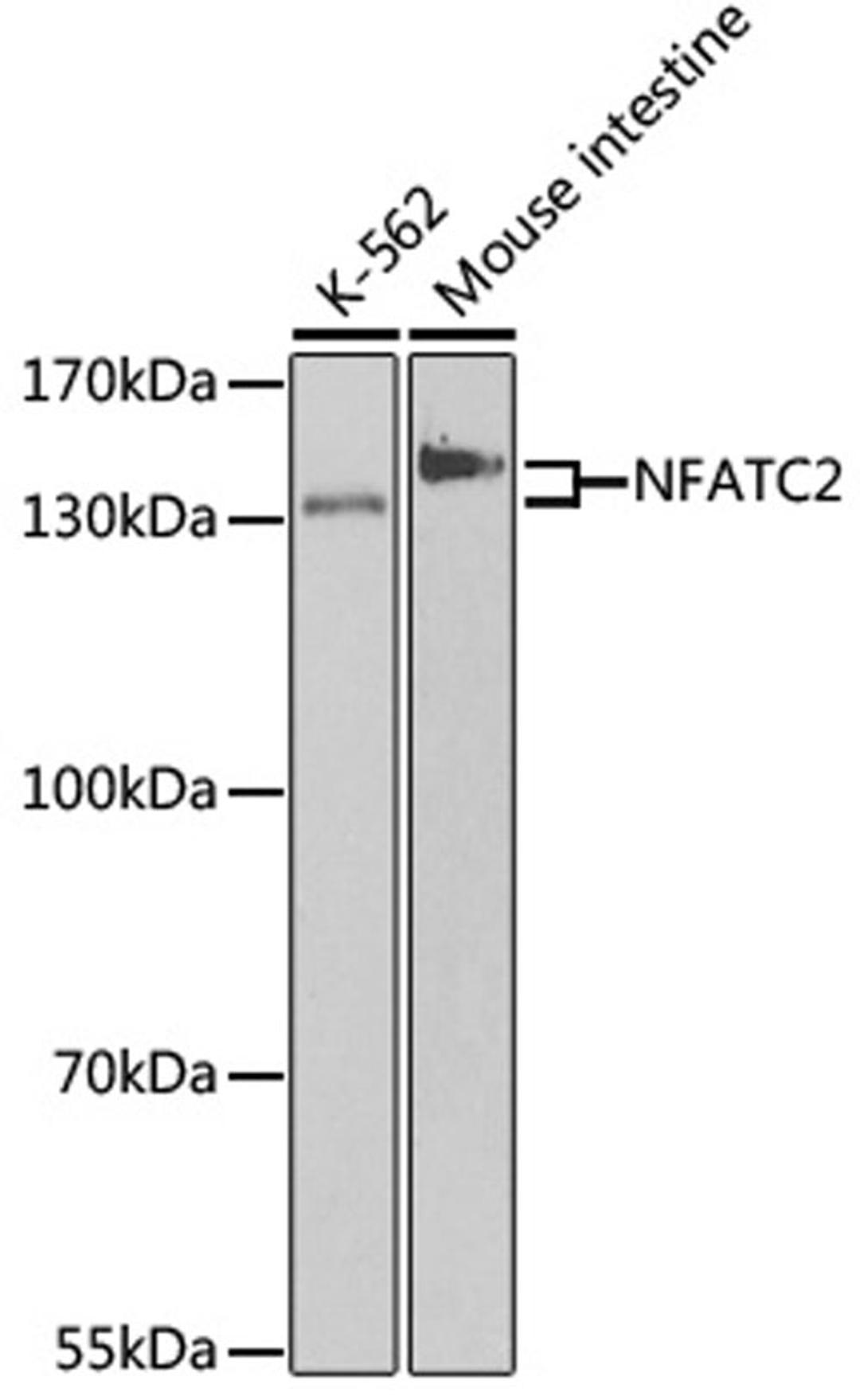 Western blot - NFATC2 antibody (A3107)