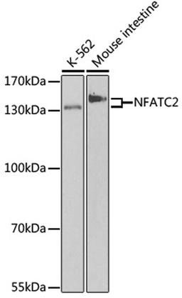 Western blot - NFATC2 antibody (A3107)