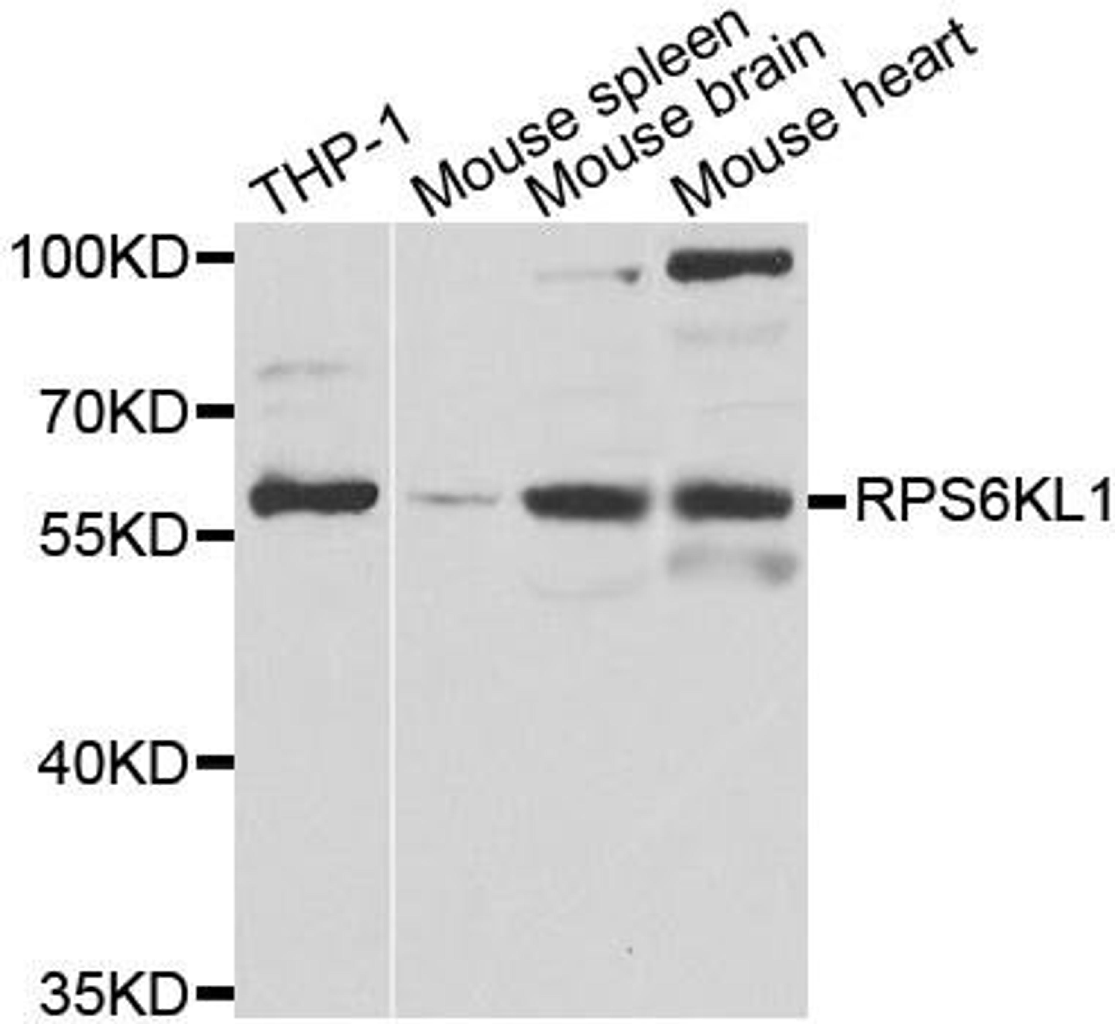 Western blot analysis of extracts of various cell lines using RPS6KL1 antibody