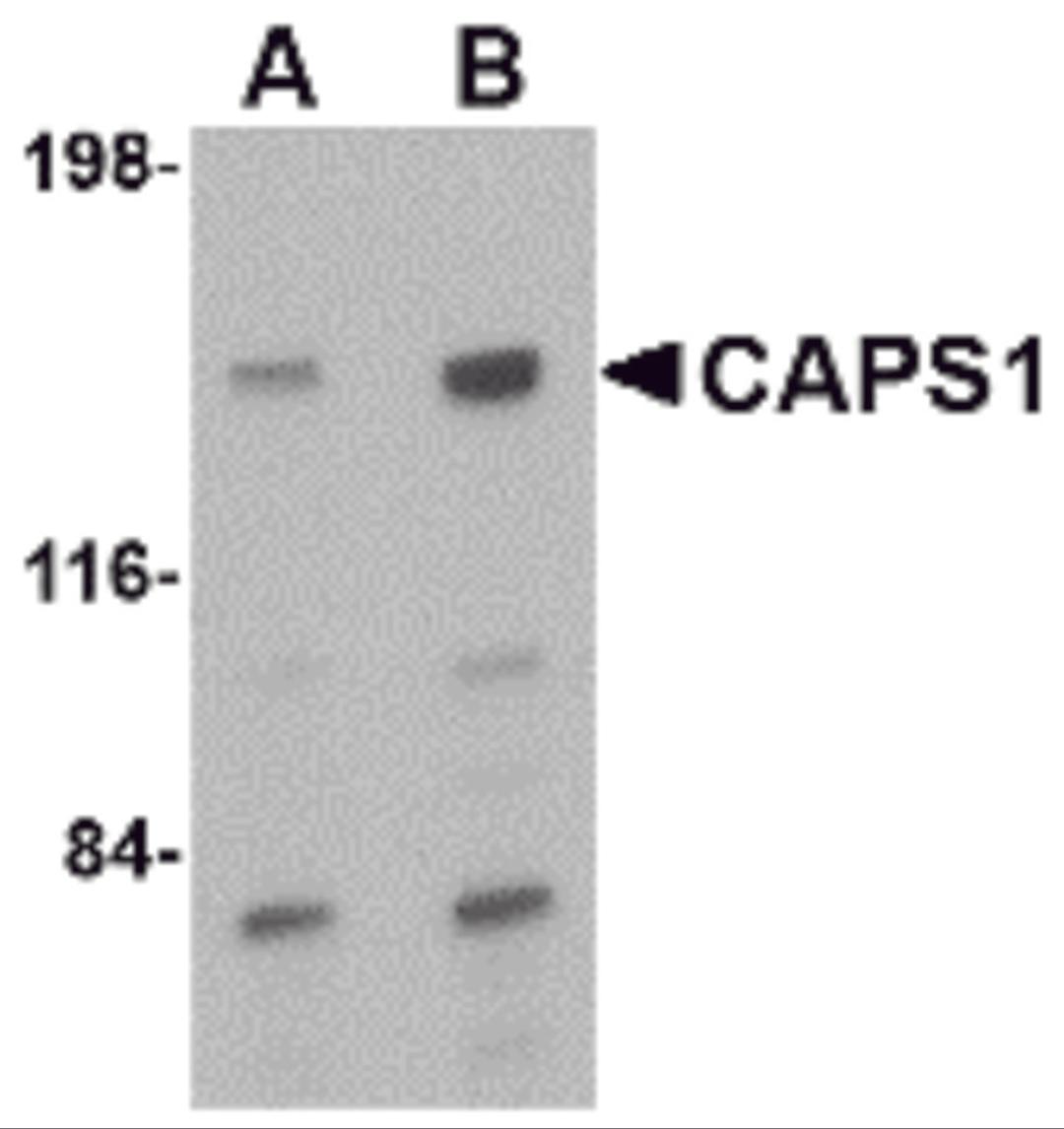 Western blot analysis of CAPS1 in rat brain tissue lysate with CAPS1 antibody at (A) 0.5 and (B) 1 μg/mL.