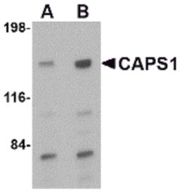 Western blot analysis of CAPS1 in rat brain tissue lysate with CAPS1 antibody at (A) 0.5 and (B) 1 μg/mL.