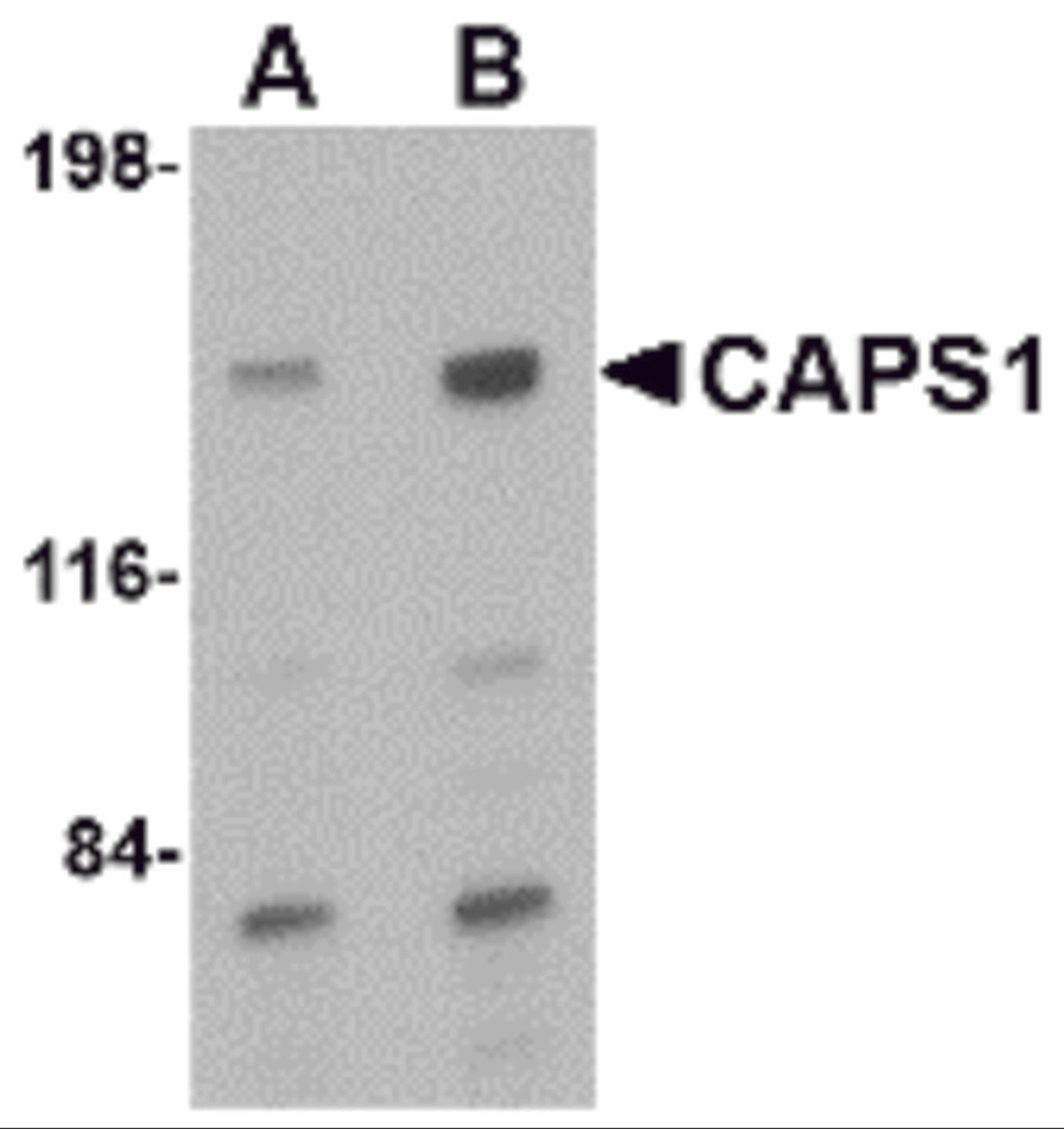 Western blot analysis of CAPS1 in rat brain tissue lysate with CAPS1 antibody at (A) 0.5 and (B) 1 μg/mL.