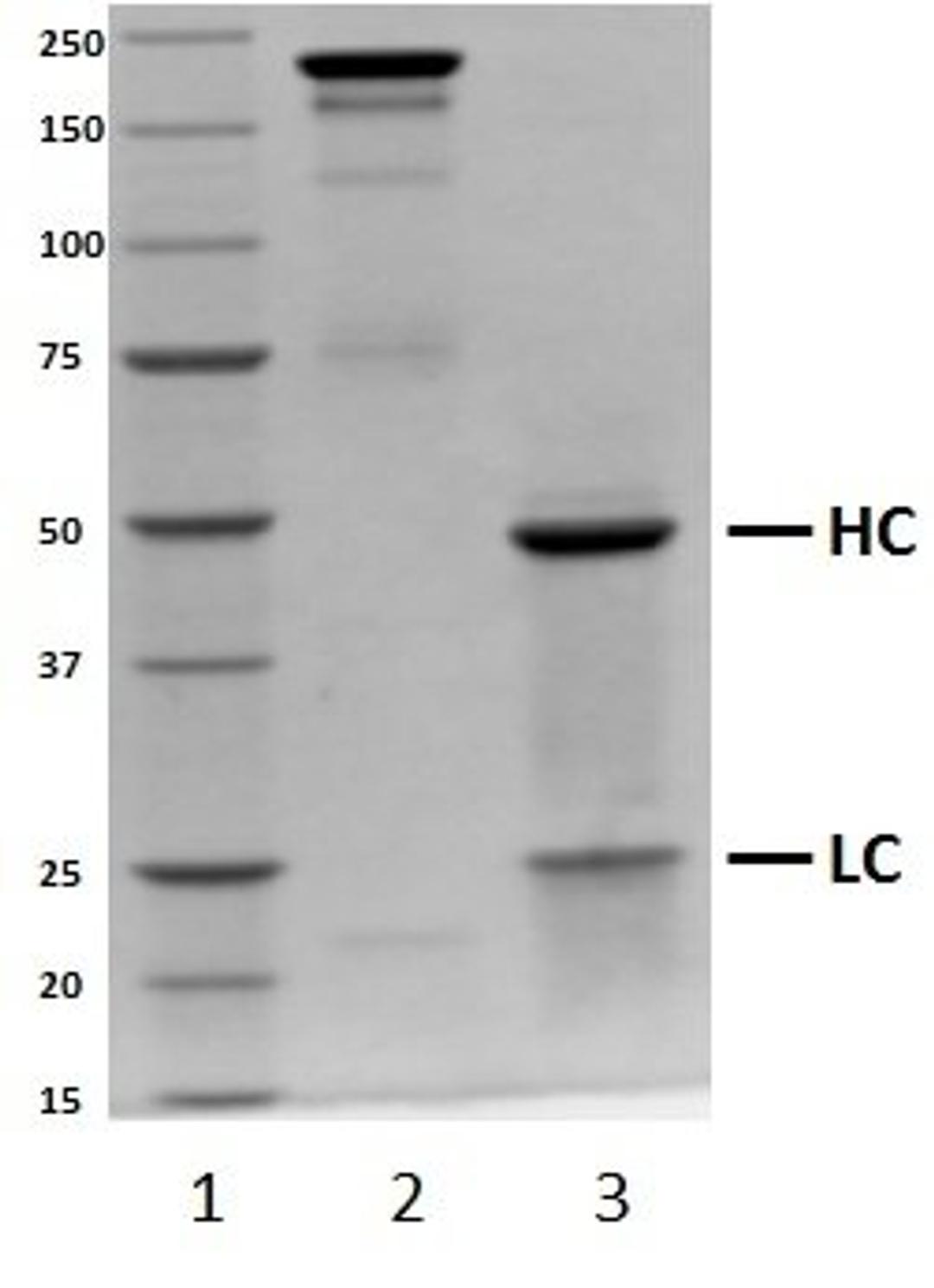 SDS-PAGE analysis of recombinant Human IgG2 lambda