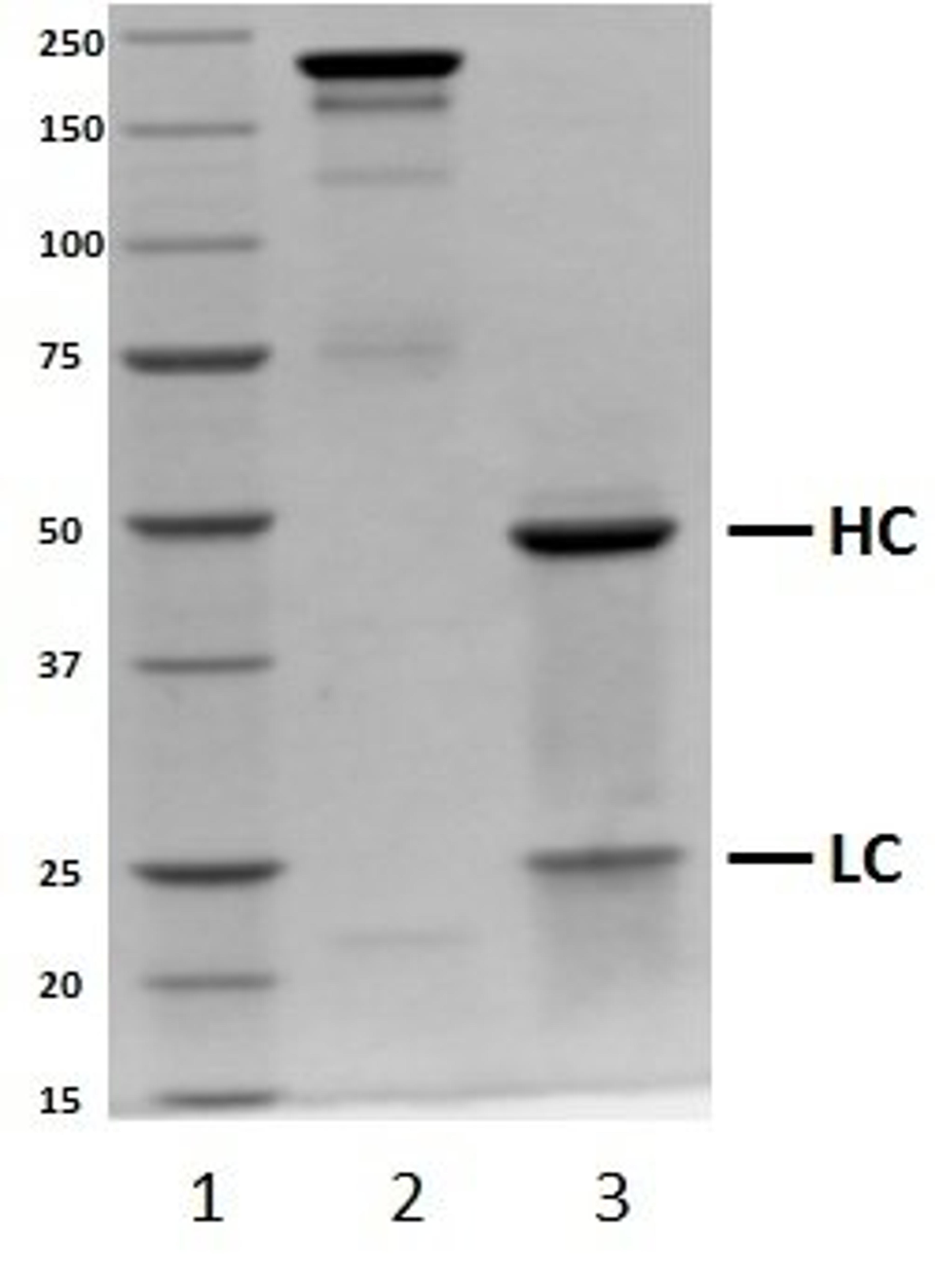 SDS-PAGE analysis of recombinant Human IgG2 lambda