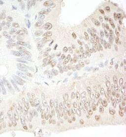 Detection of human C1orf55 by immunohistochemistry.