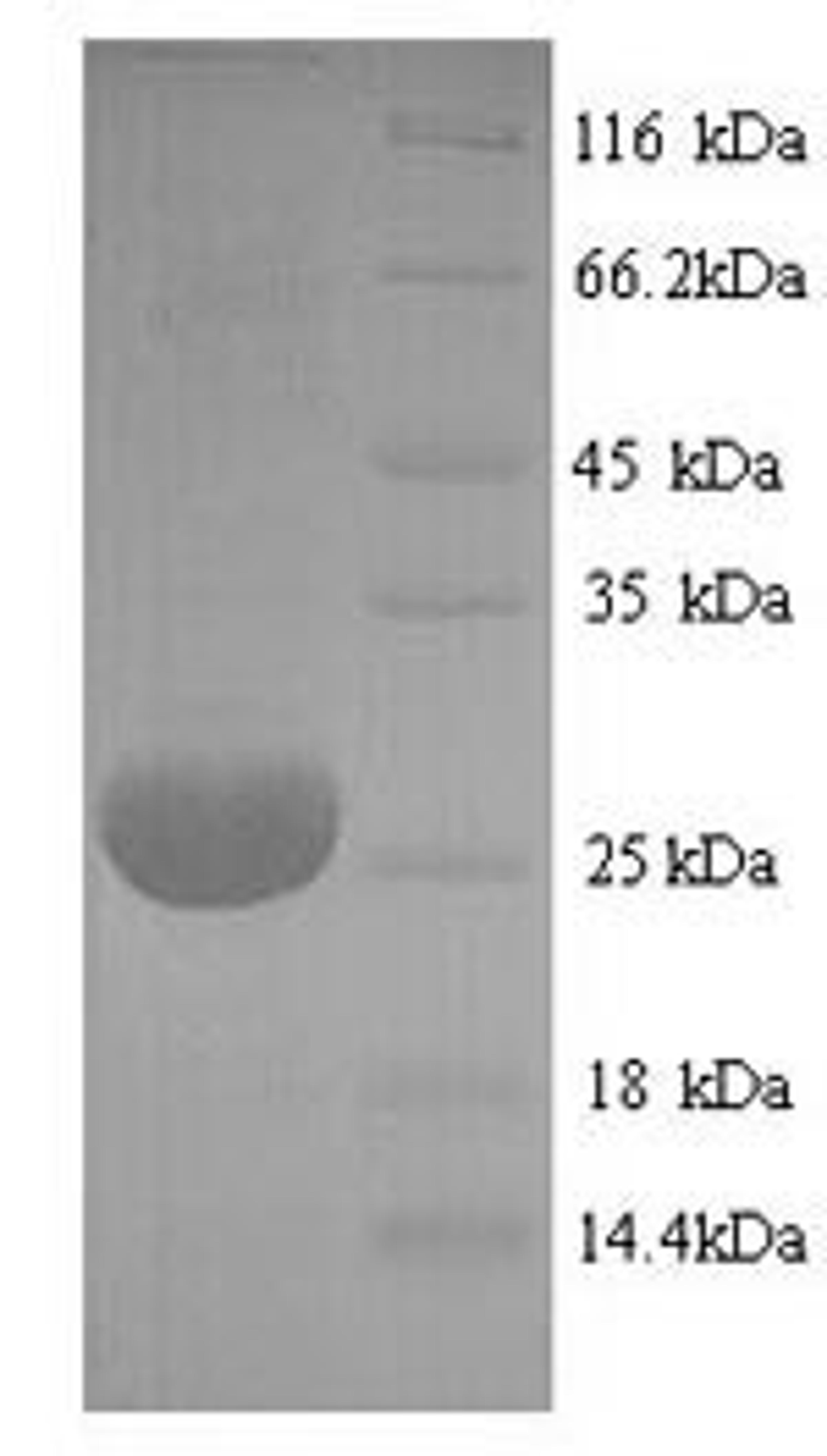(Tris-Glycine gel) Discontinuous SDS-PAGE (reduced) with 5% enrichment gel and 15% separation gel.