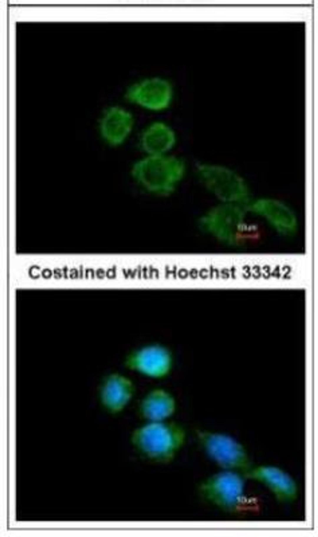 Immunocytochemistry/Immunofluorescence: APJ/Apelin receptor Antibody [NBP1-30869] -  Analysis of methanol-fixed A431, using Apelin Receptor.