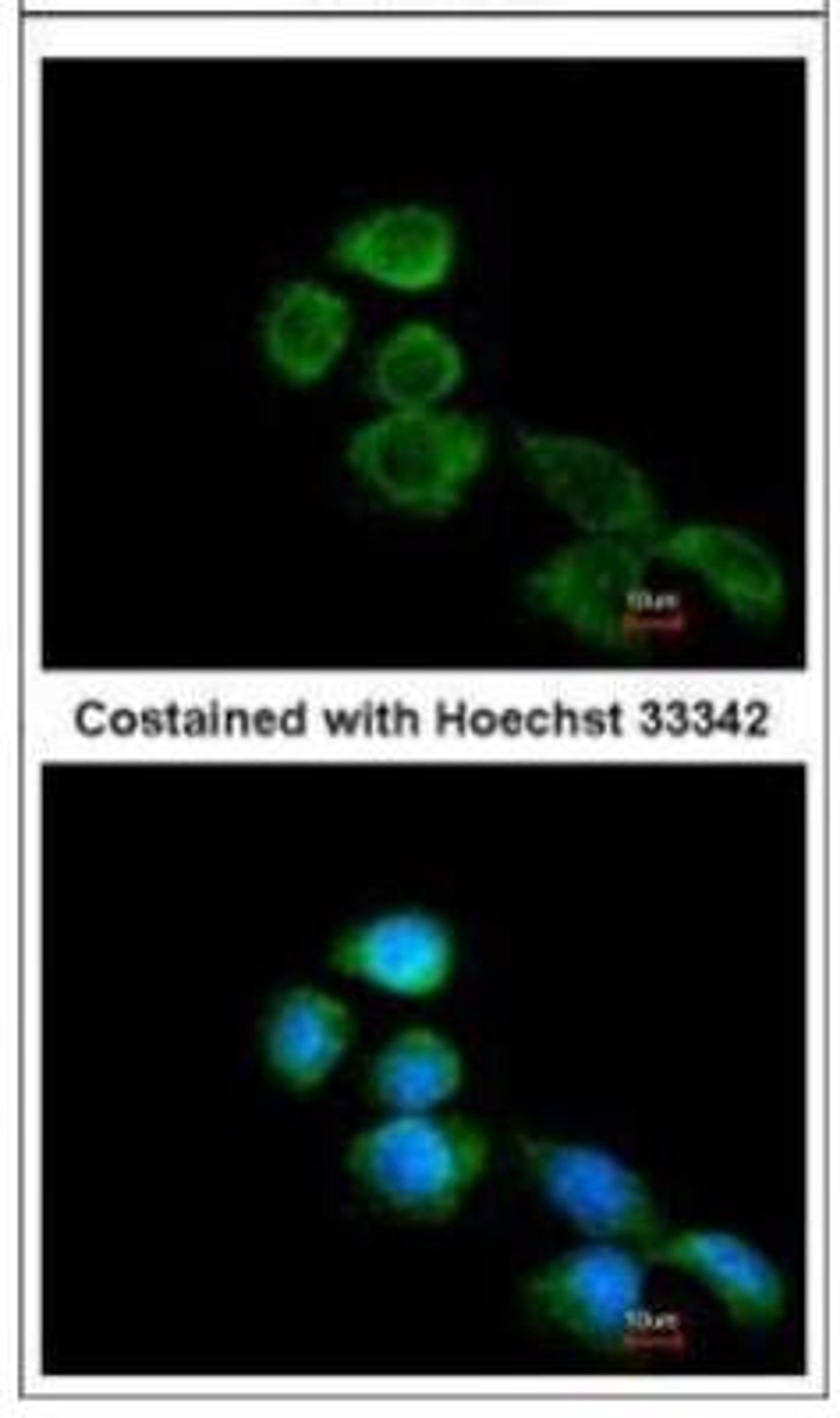 Immunocytochemistry/Immunofluorescence: APJ/Apelin receptor Antibody [NBP1-30869] -  Analysis of methanol-fixed A431, using Apelin Receptor.