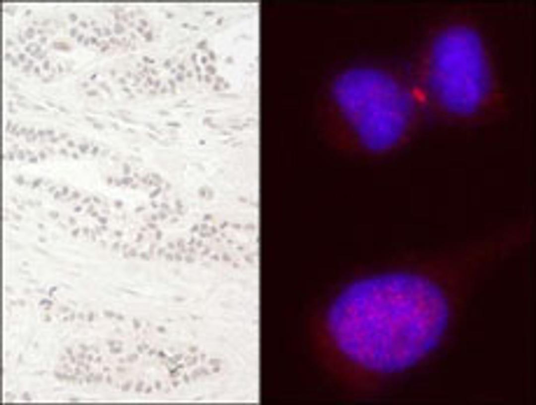 Detection of human KIF14 by immunohistochemistry and immunocytochemistry.