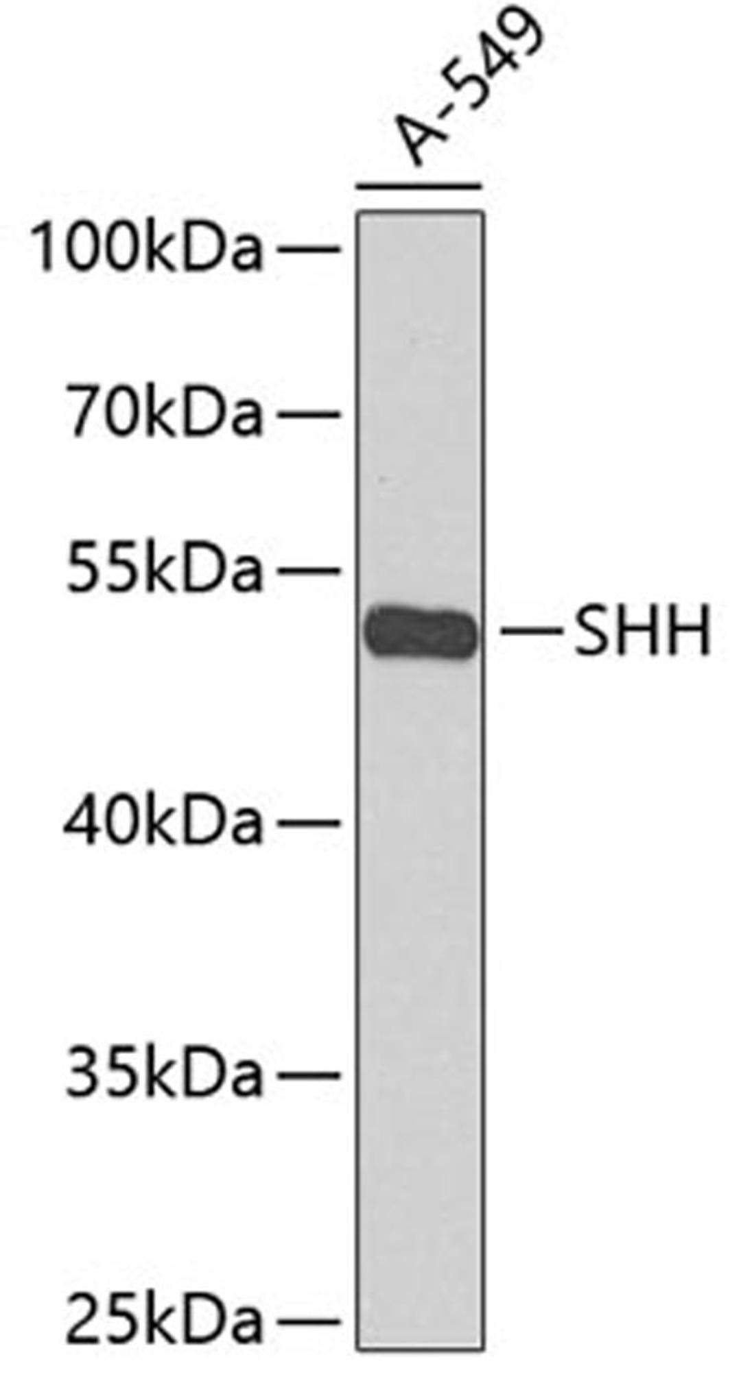 Western blot - SHH antibody (A12503)