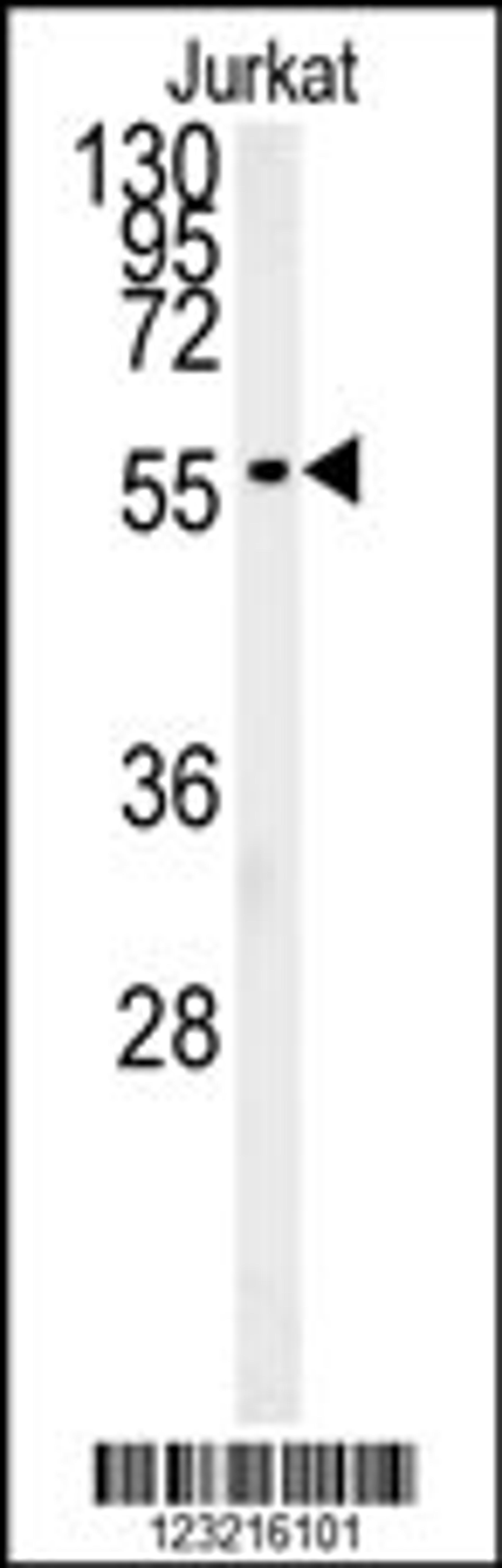 Western blot analysis of ADFP Antibody in Jurkat cell line lysates (35ug/lane)