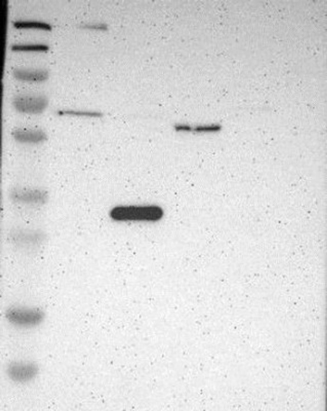 Western Blot: PARP14 Antibody [NBP1-93593] - Lane 1: Marker [kDa] 230, 130, 95, 72, 56, 36, 28, 17, 11<br/>Lane 2: RT-4<br/>Lane 3: U-251 MG<br/>Lane 4: Human Plasma<br/>Lane 5: Liver<br/>Lane 6: Tonsil