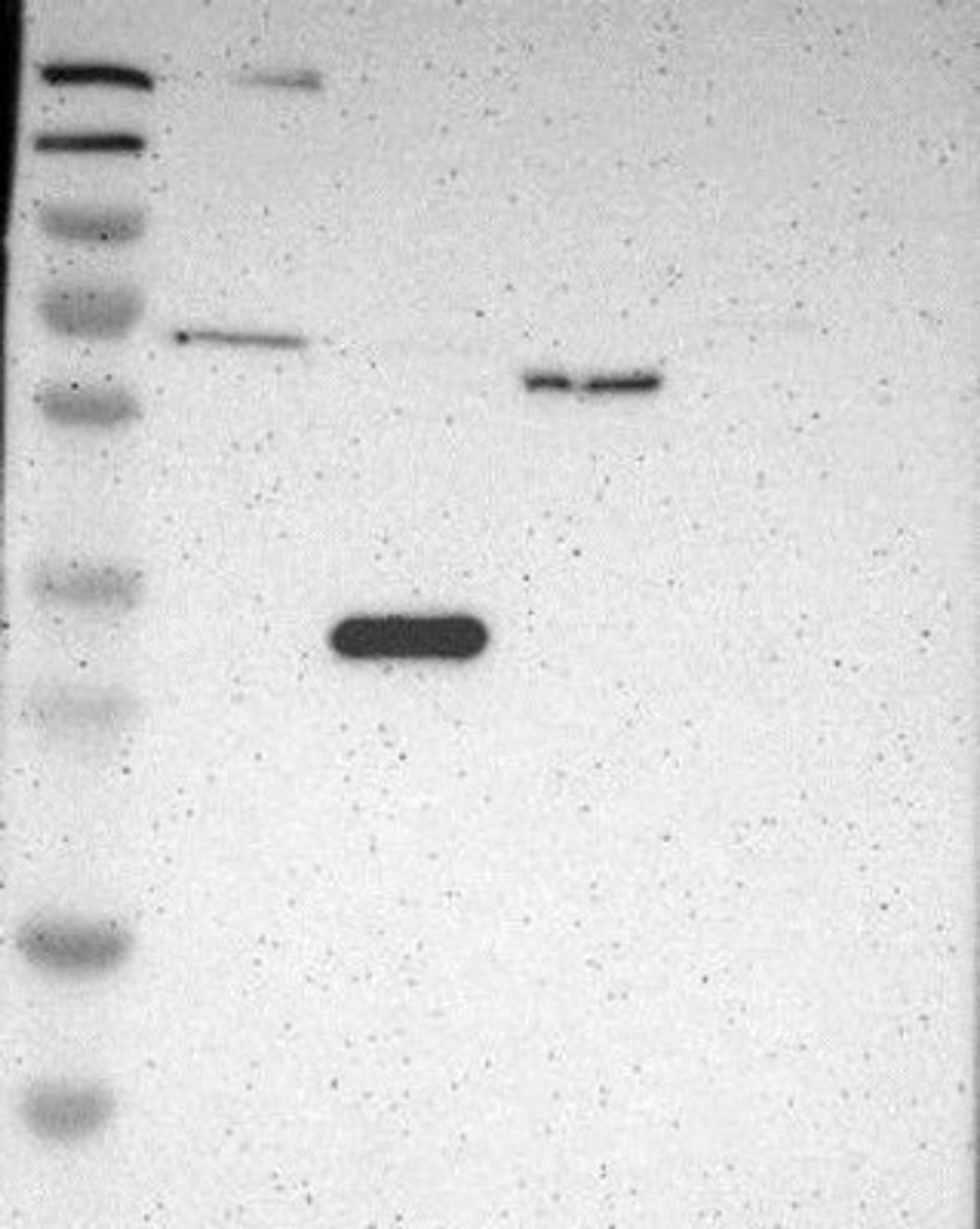 Western Blot: PARP14 Antibody [NBP1-93593] - Lane 1: Marker [kDa] 230, 130, 95, 72, 56, 36, 28, 17, 11<br/>Lane 2: RT-4<br/>Lane 3: U-251 MG<br/>Lane 4: Human Plasma<br/>Lane 5: Liver<br/>Lane 6: Tonsil