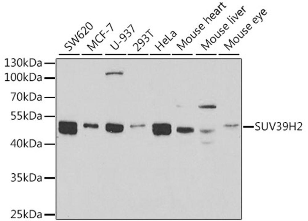 Western blot - SUV39H2 antibody (A5855)