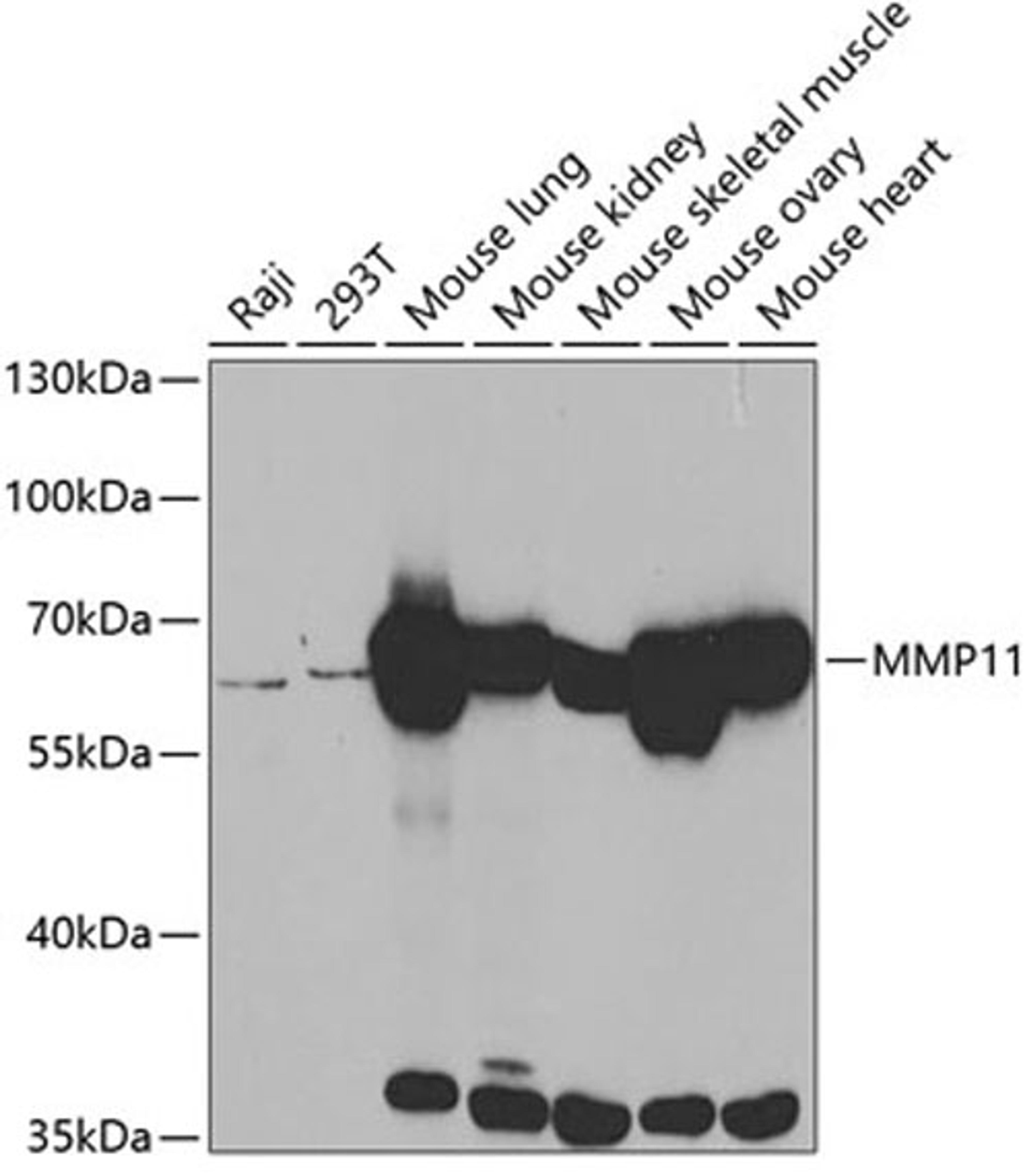 Western blot - MMP11 antibody (A3034)