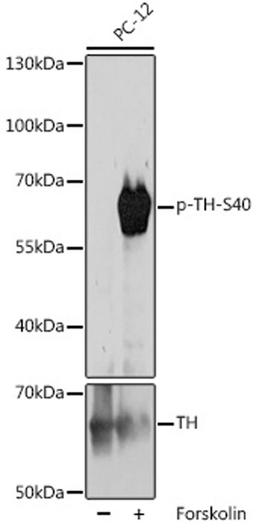 Western blot - Phospho-TH-S40 pAb (AP1109)