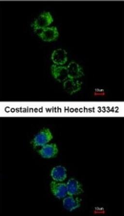 Immunocytochemistry/Immunofluorescence: GSTA2 Antibody [NBP1-32157] - Analysis of methanol-fixed Hep G2, using antibody at 1:500 dilution.