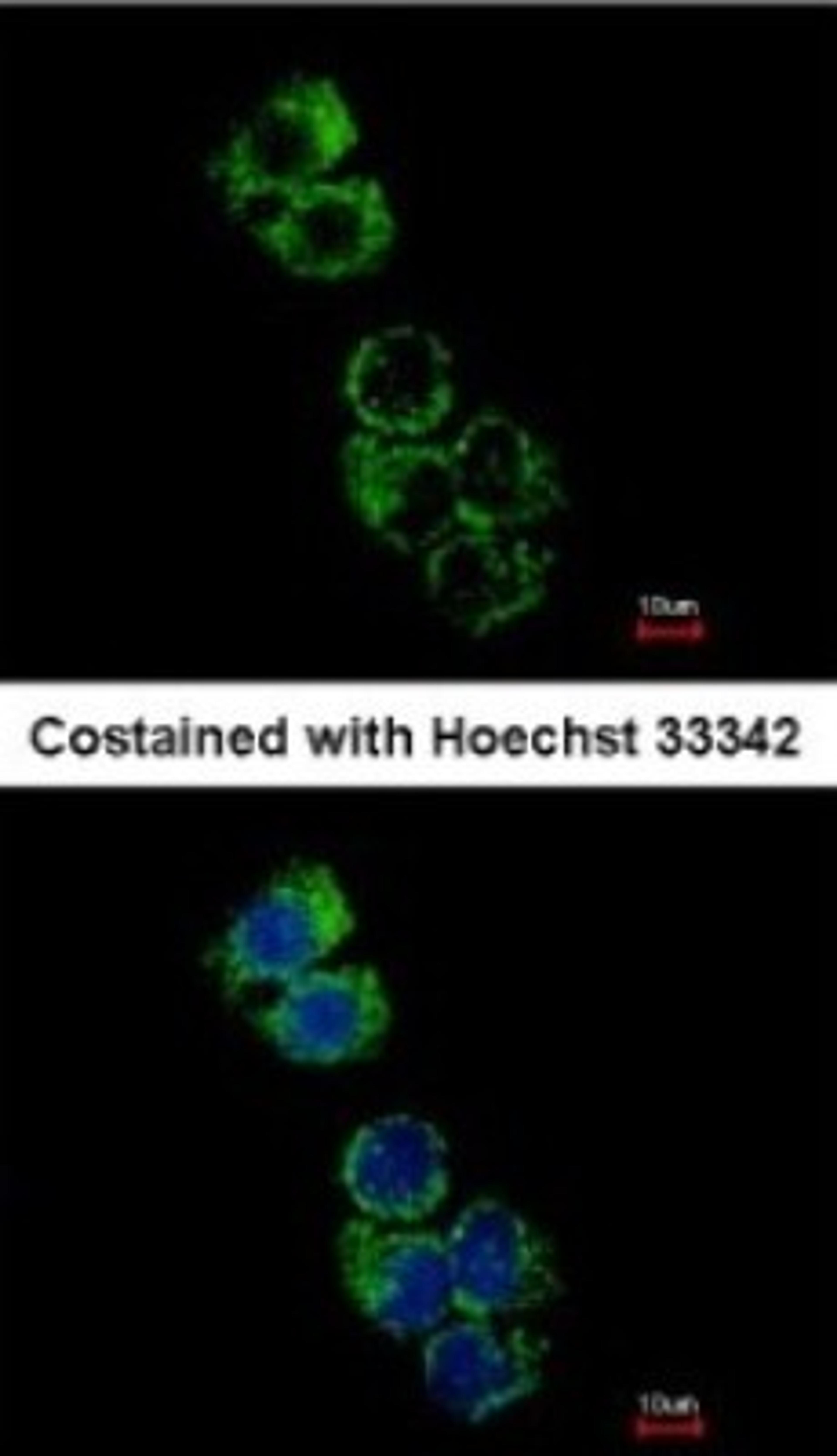 Immunocytochemistry/Immunofluorescence: GSTA2 Antibody [NBP1-32157] - Analysis of methanol-fixed Hep G2, using antibody at 1:500 dilution.