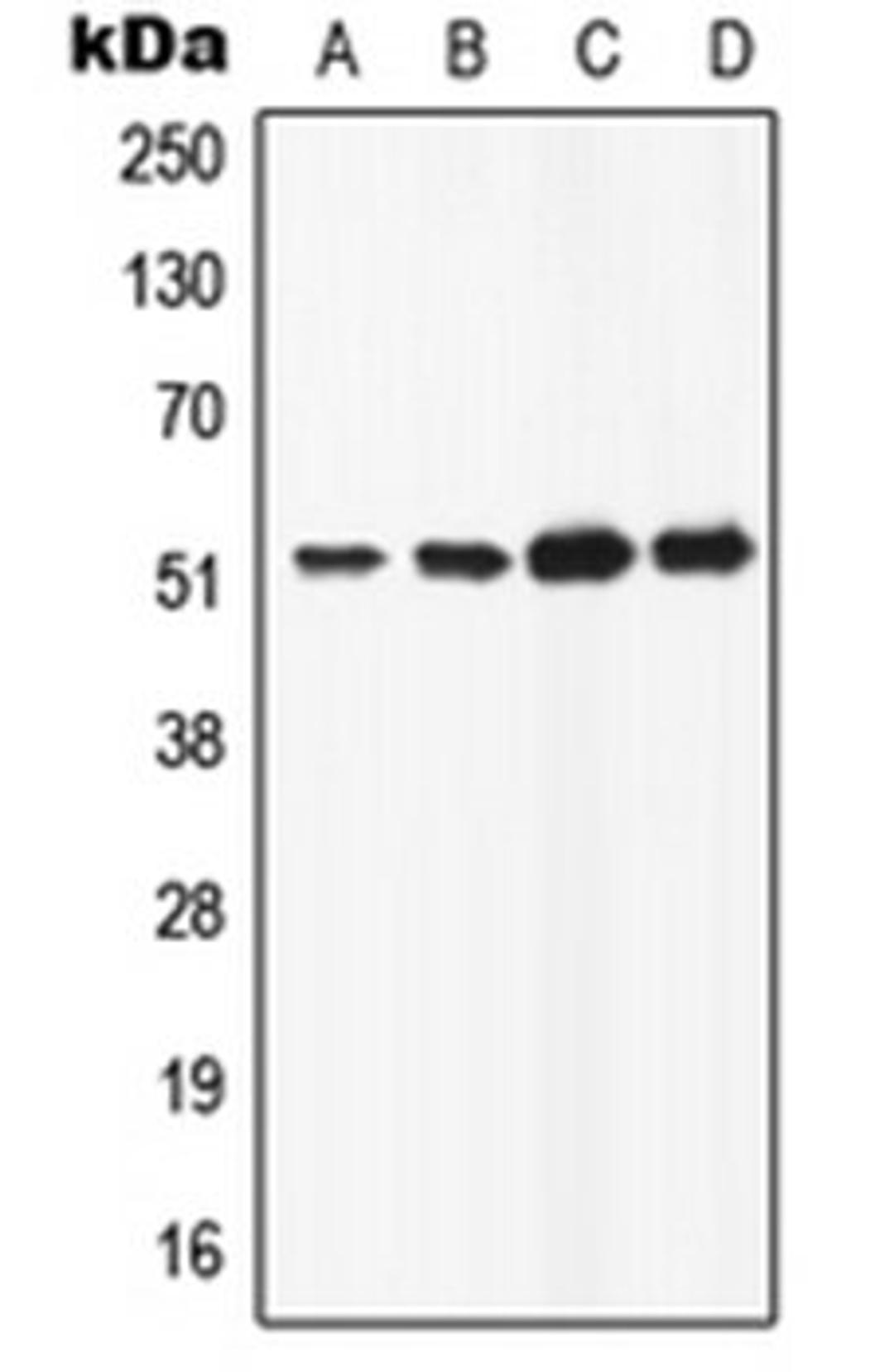 Western blot analysis of HeLa (Lane 1), HepG2 (Lane 2), Raw264.7 (Lane 3), H9C2 (Lane 4) whole cell lysates using ATP6AP1 antibody