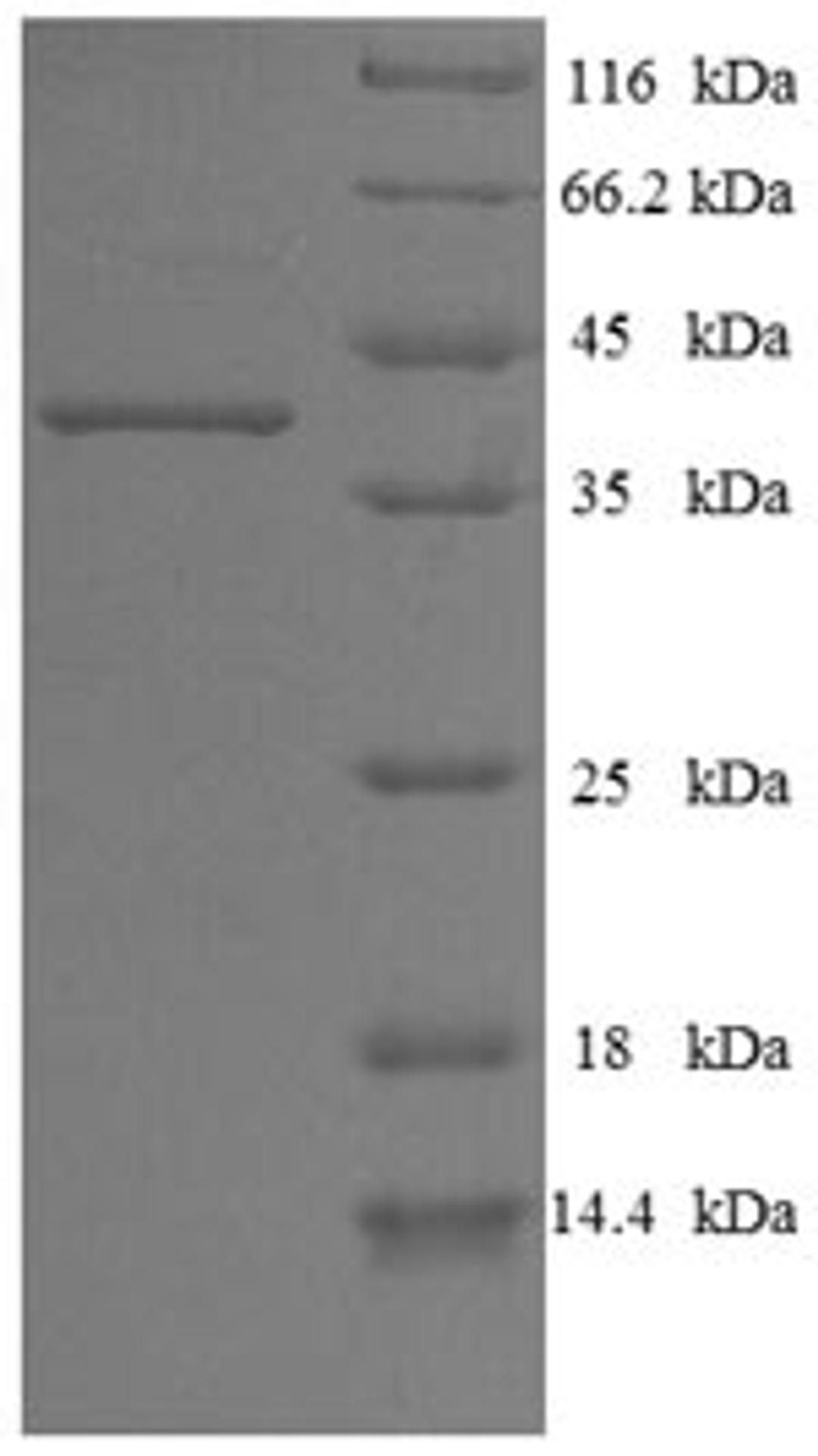 (Tris-Glycine gel) Discontinuous SDS-PAGE (reduced) with 5% enrichment gel and 15% separation gel.