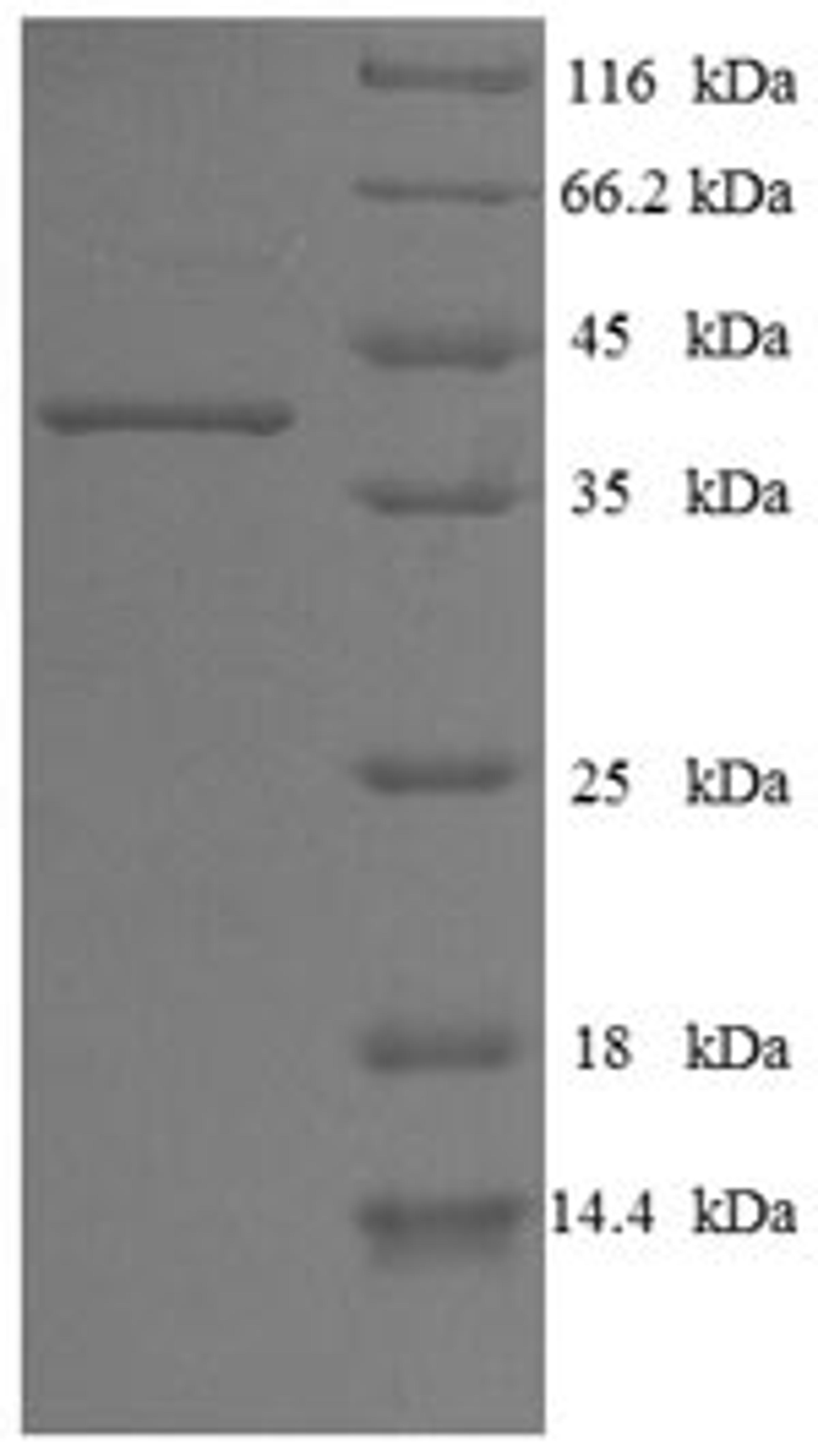 (Tris-Glycine gel) Discontinuous SDS-PAGE (reduced) with 5% enrichment gel and 15% separation gel.