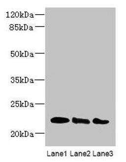 Western blot. All lanes: ARL8B antibody at 4µg/ml. Lane 1: Mouse brain tissue. Lane 2: NIH/3T3 whole cell lysate. Lane 3: Jurkat whole cell lysate. Secondary. Goat polyclonal to rabbit IgG at 1/10000 dilution. Predicted band size: 22, 19 kDa. Observed band size: 22 kDa