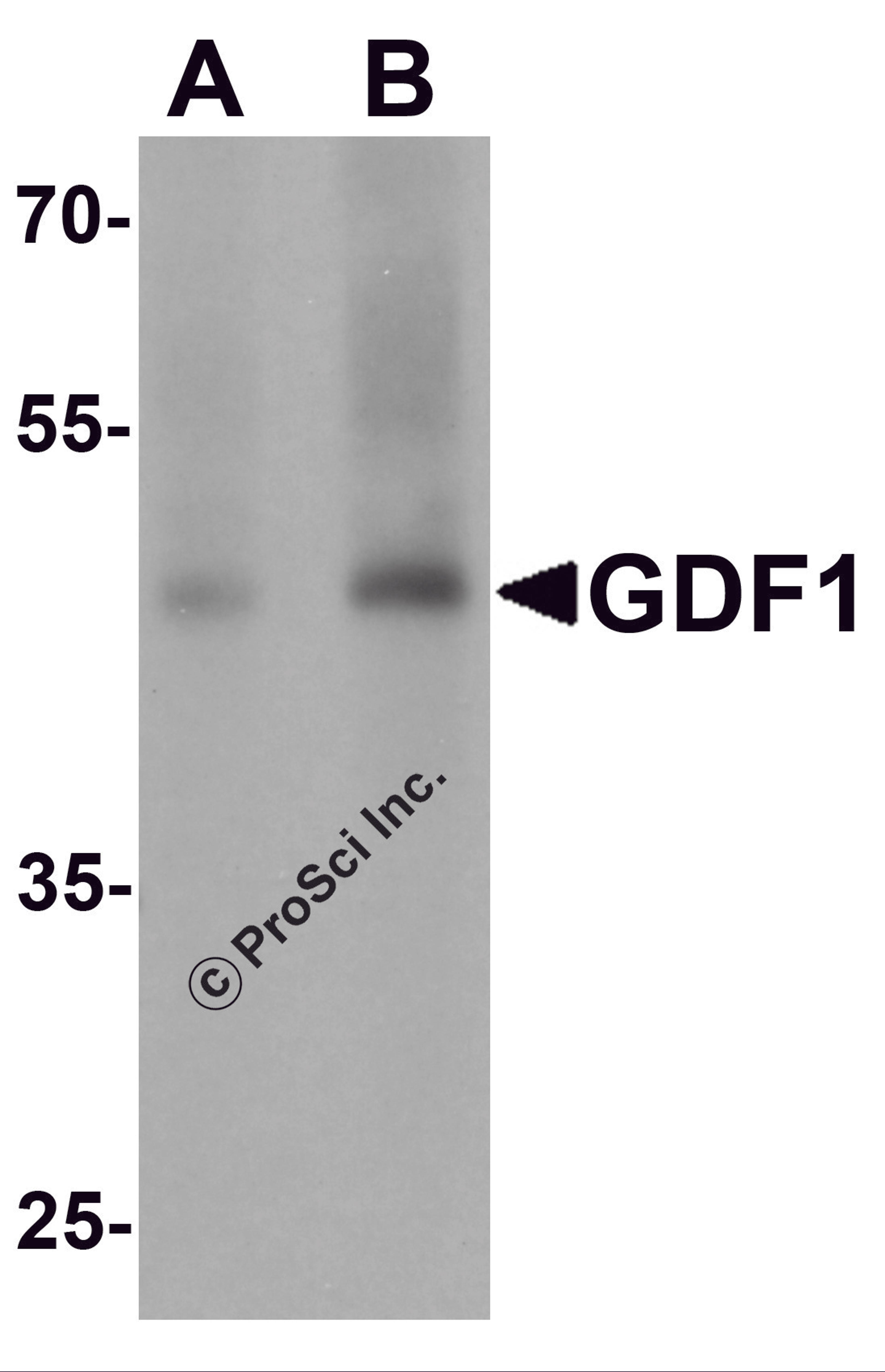 Western blot analysis of GDF1 in rat lung tissue lysate with GDF1 antibody at (A) 1 and (B) 2 μg/mL.