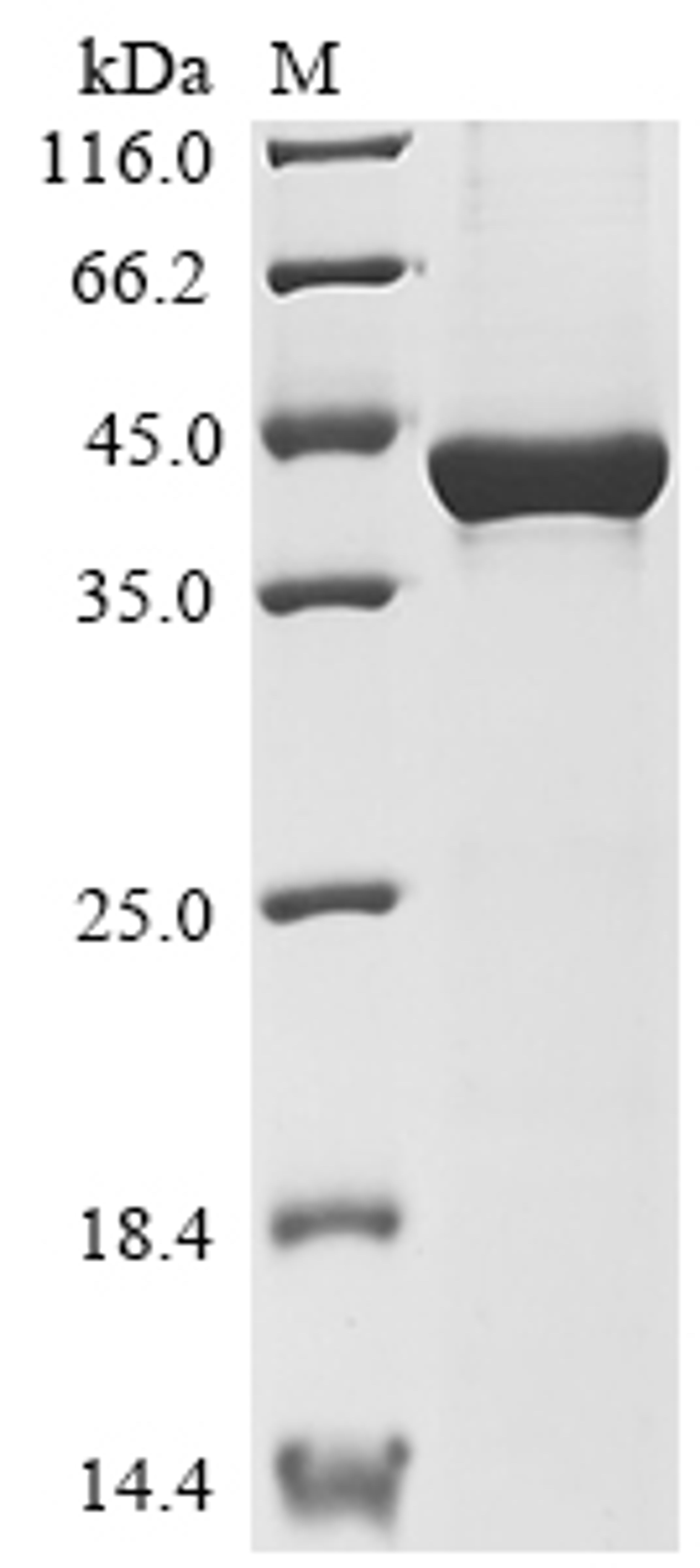 (Tris-Glycine gel) Discontinuous SDS-PAGE (reduced) with 5% enrichment gel and 15% separation gel.