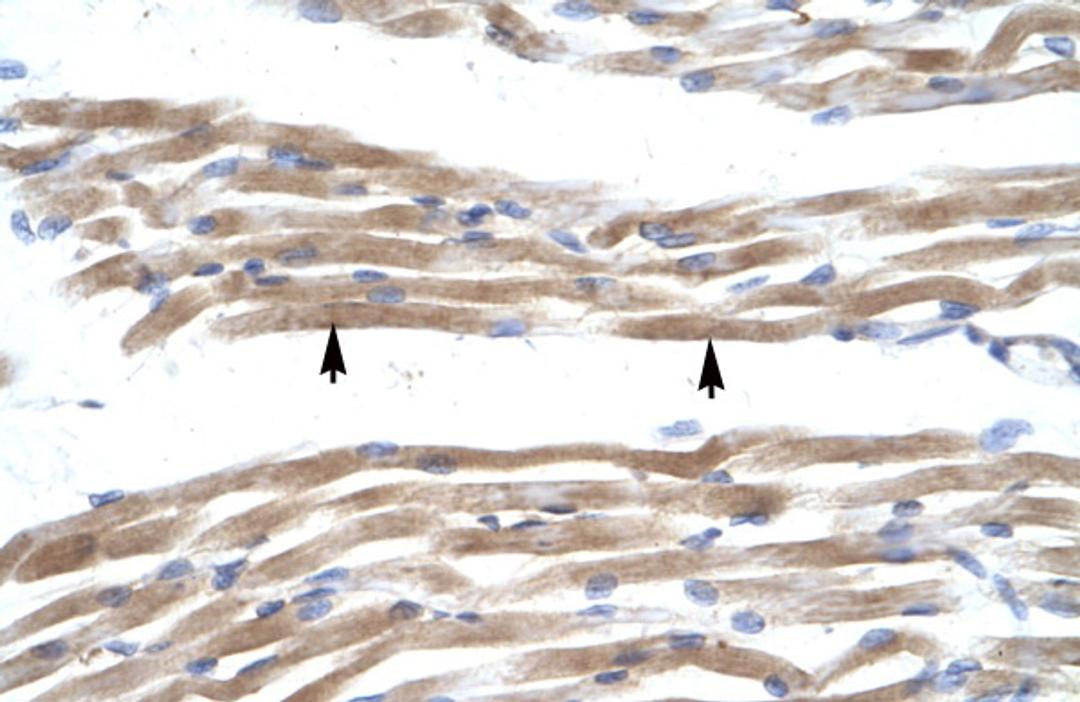 Antibody used in IHC on Human Muscle.