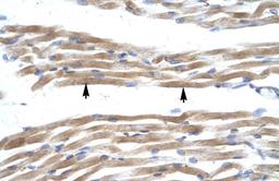 Antibody used in IHC on Human Muscle.