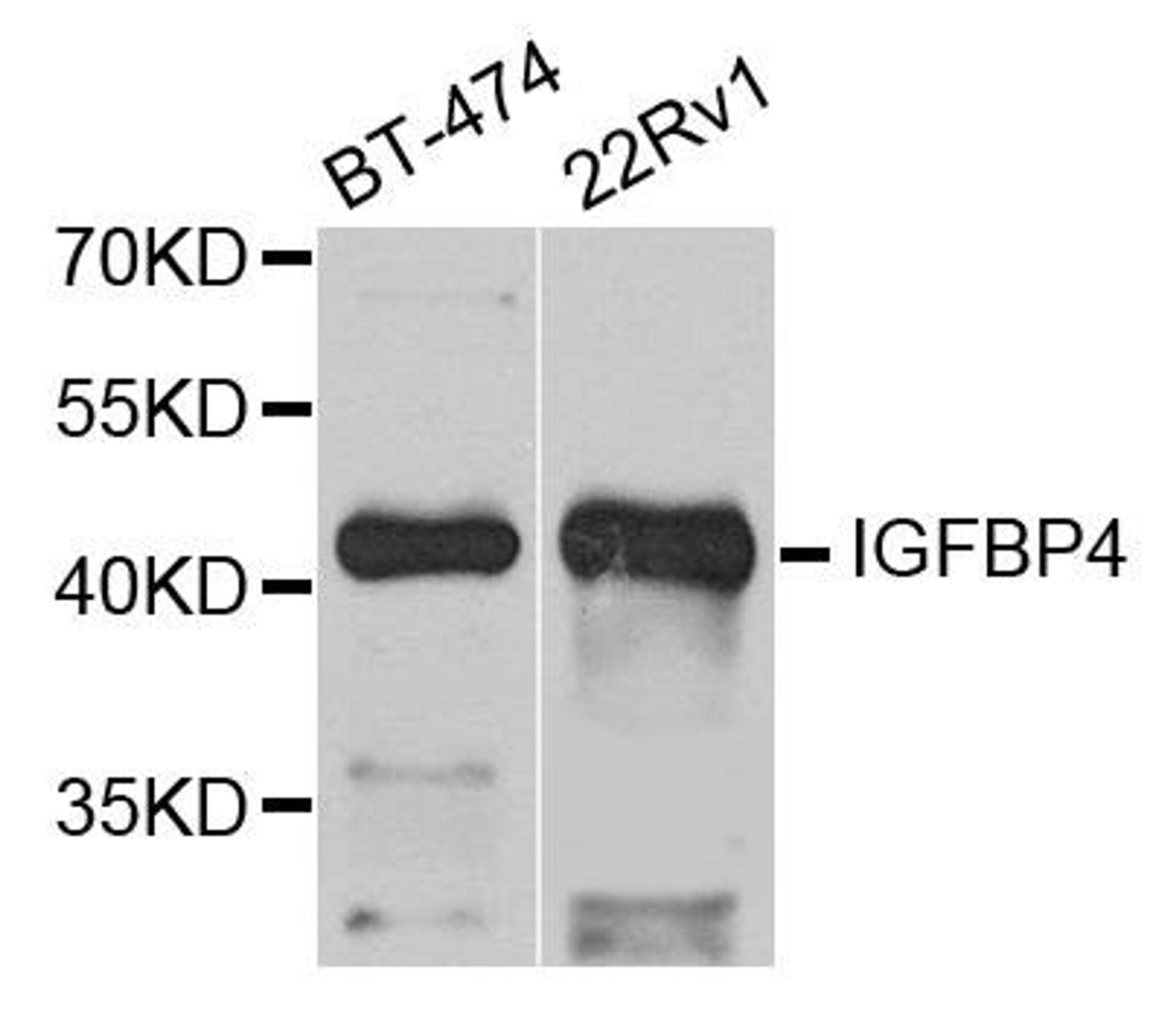 Western blot analysis of extract of various cells using IGFBP4 antibody