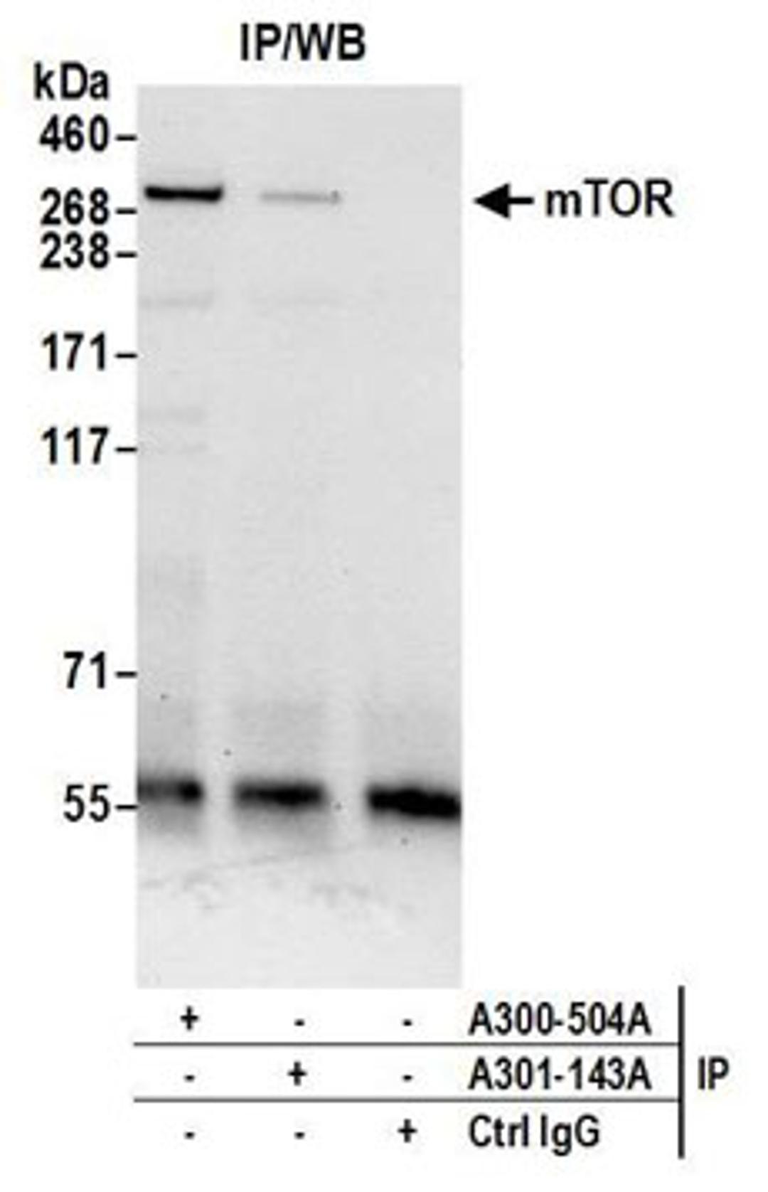 Detection of human mTOR by western blot of immunoprecipitates.